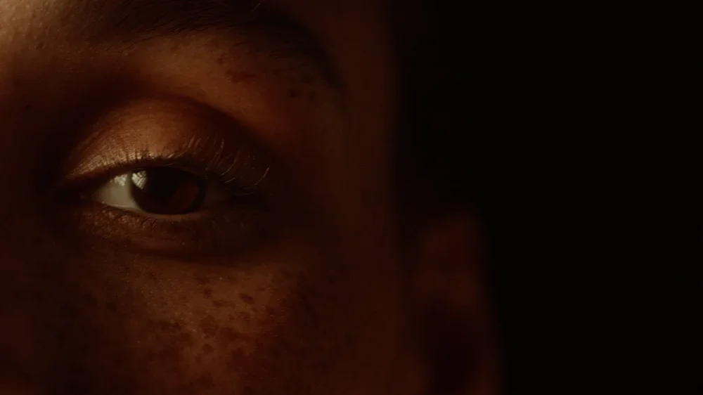 Close-up of a person's face focusing on one eye and surrounding freckles, with dark background.