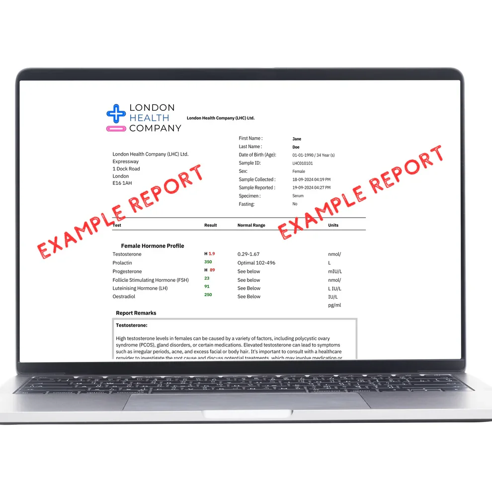 HbA1c-Blood-test-result-quantitative-report.webp