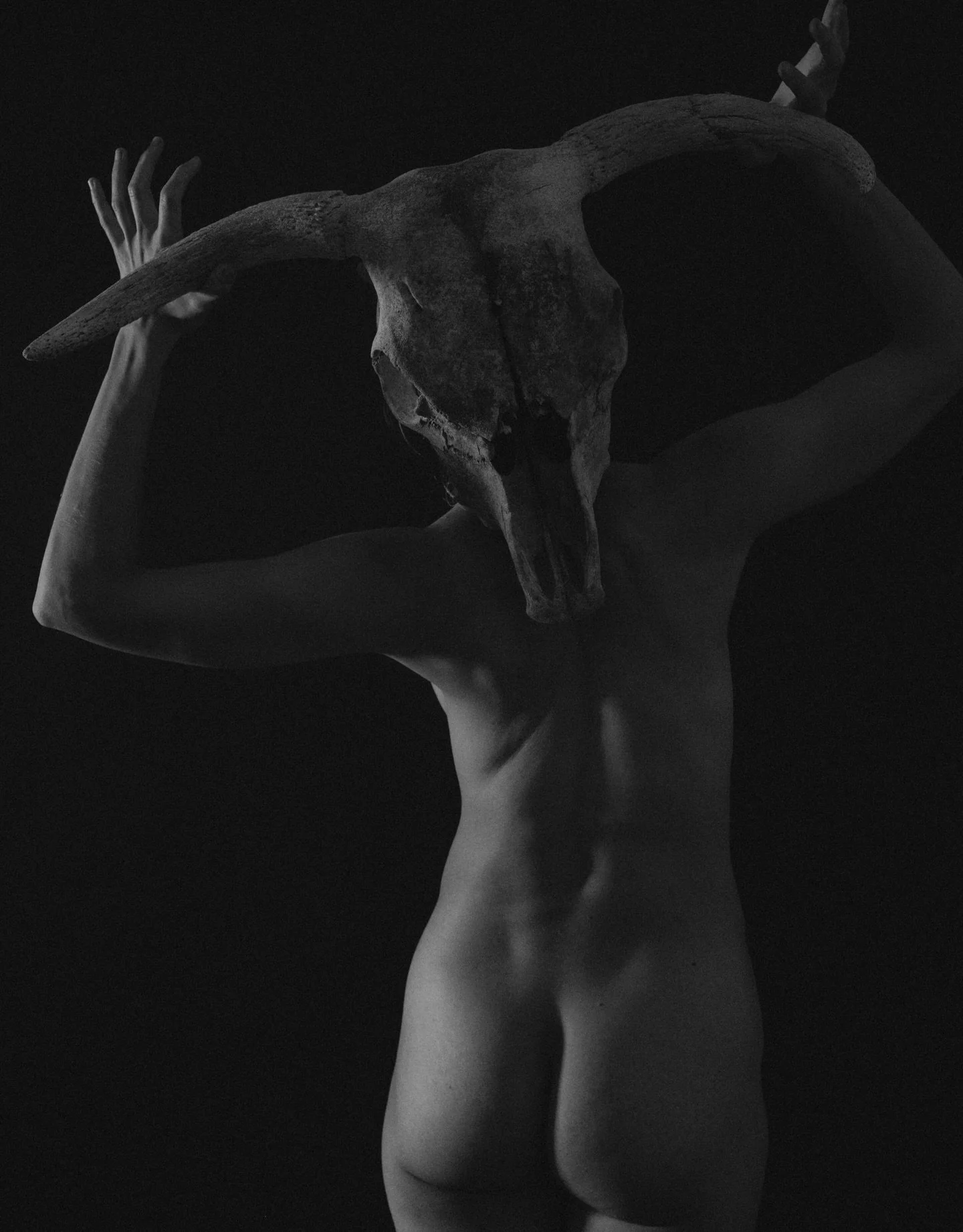 help. I&rsquo;m on day 5 of a migraine. mine are visual aura subtype and start with colorful (usually silver with blue or red) flashing zig-zags, then loss of vision either fully in one eye or tunnel vision from both. then nausea as I panic looking f