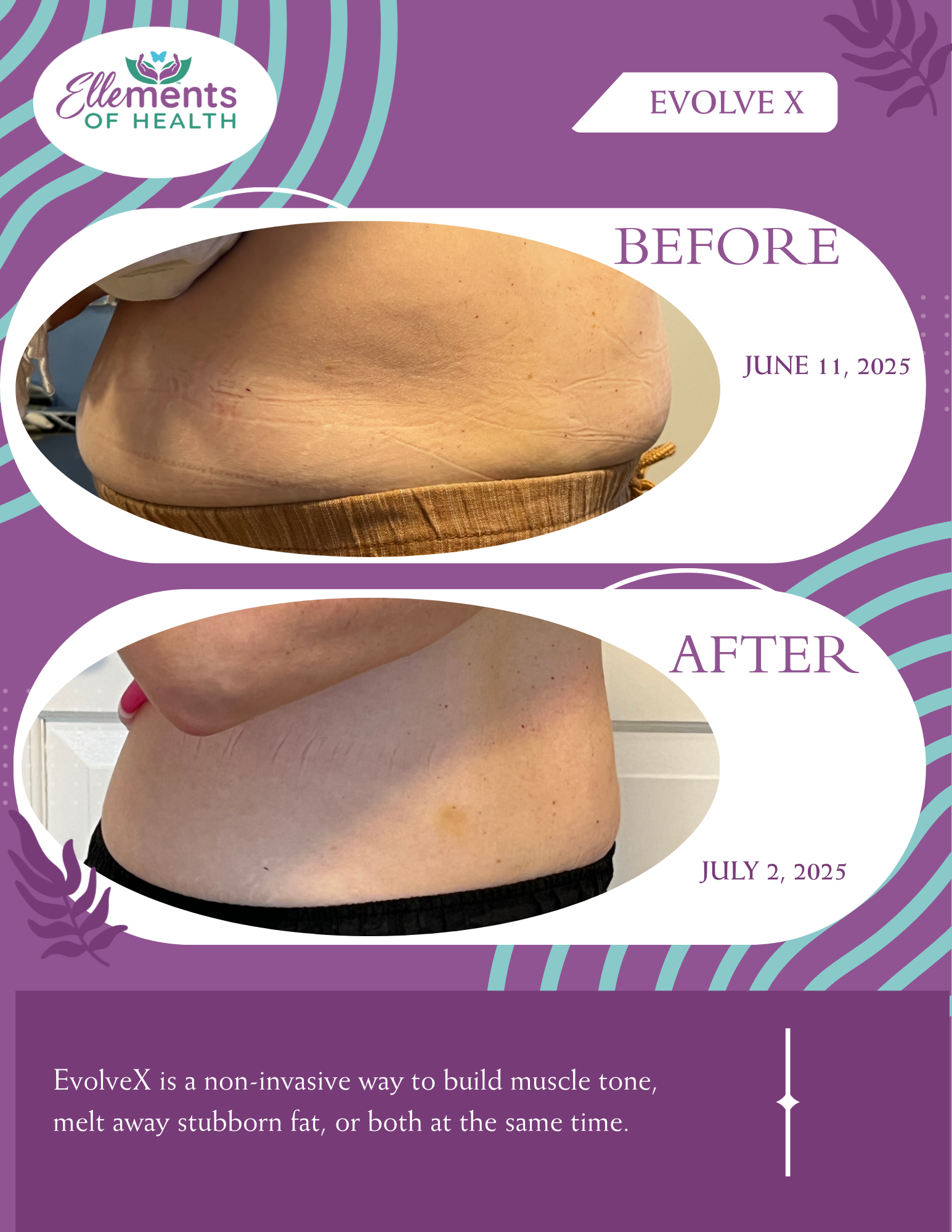 Before and after with EvolveX. Waist line reduced, and new clothes ordered!