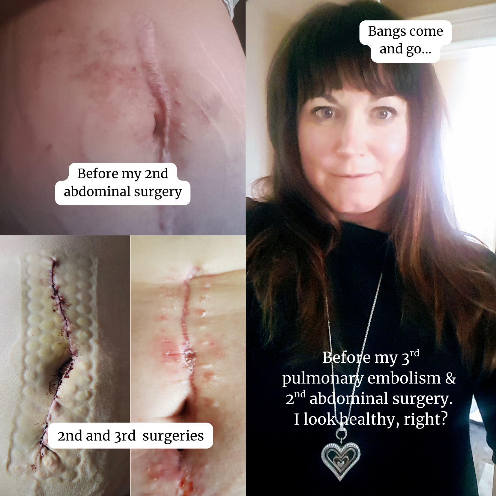 scars in various stages of healing