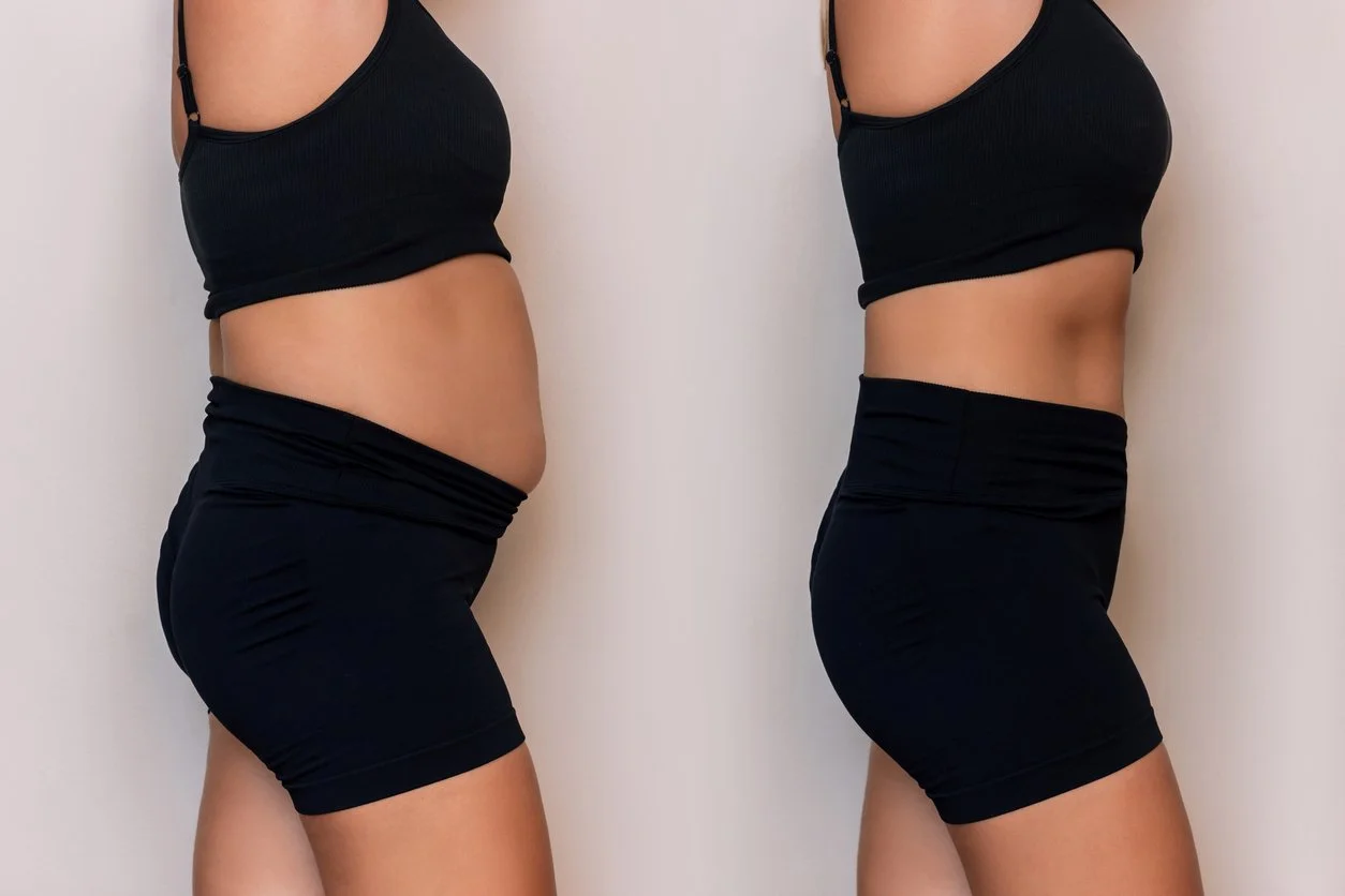 Side-by-side comparison of a woman before and after weight loss, showing a slimmer waist and flatter stomach.