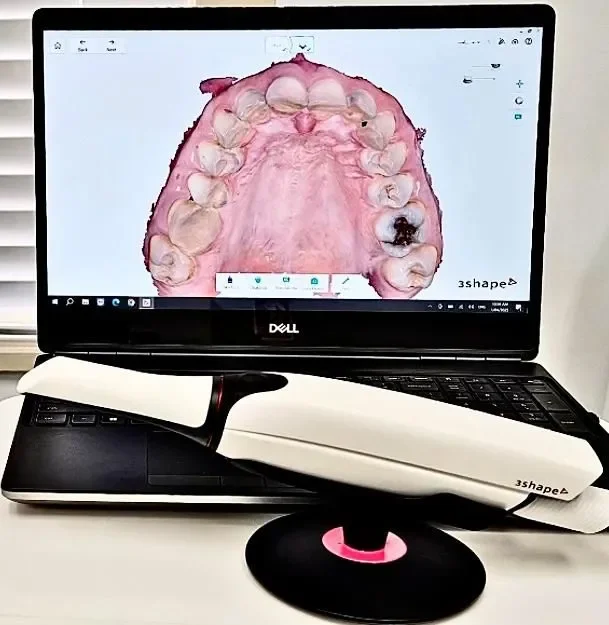 A laptop displaying a 3D digital model of a human upper jaw with teeth, showing dental details. A dental scanner device is placed on top of the laptop keyboard.