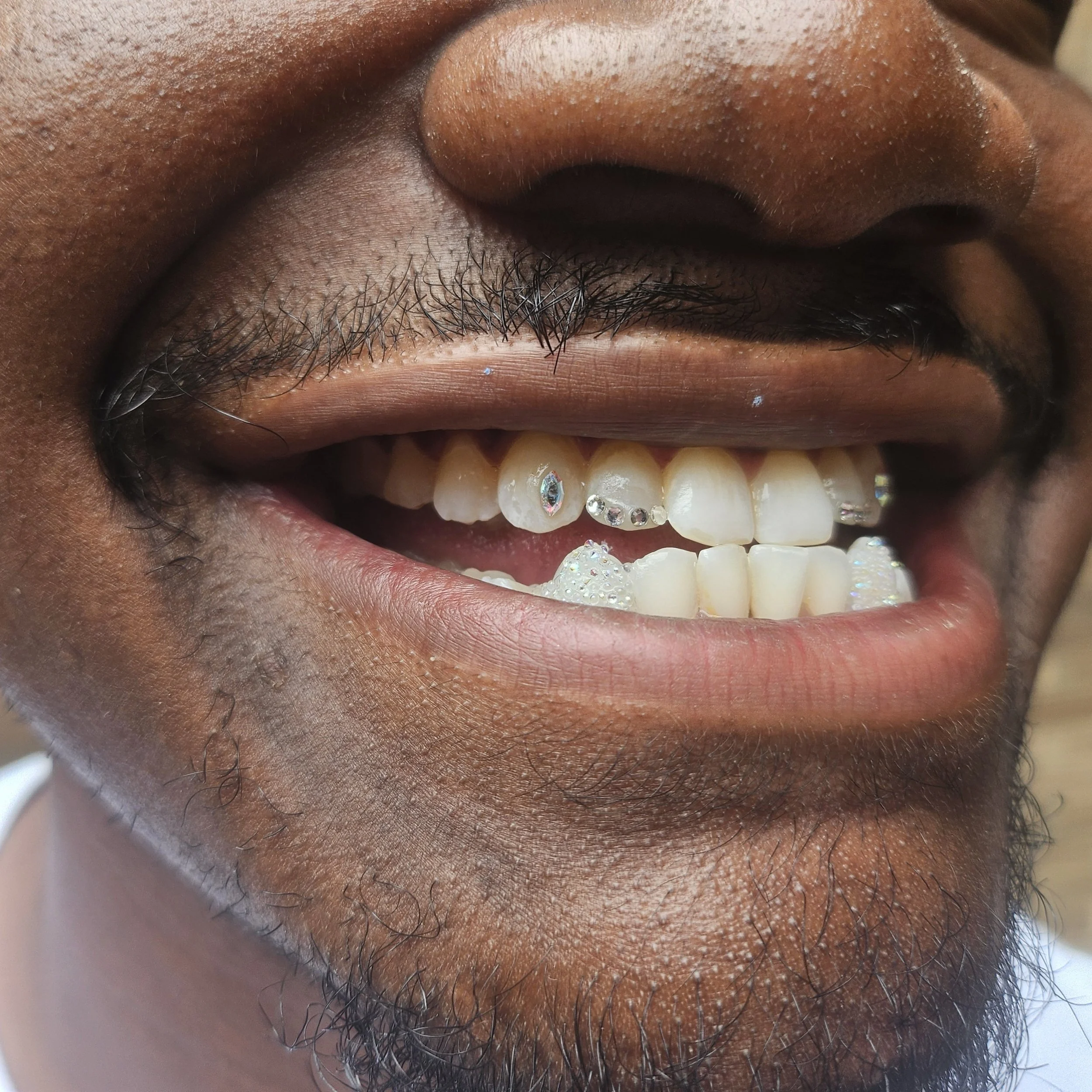 Close-up of a smiling person showing jewelry on teeth and lip, with some foam and bubbles on lips and teeth.