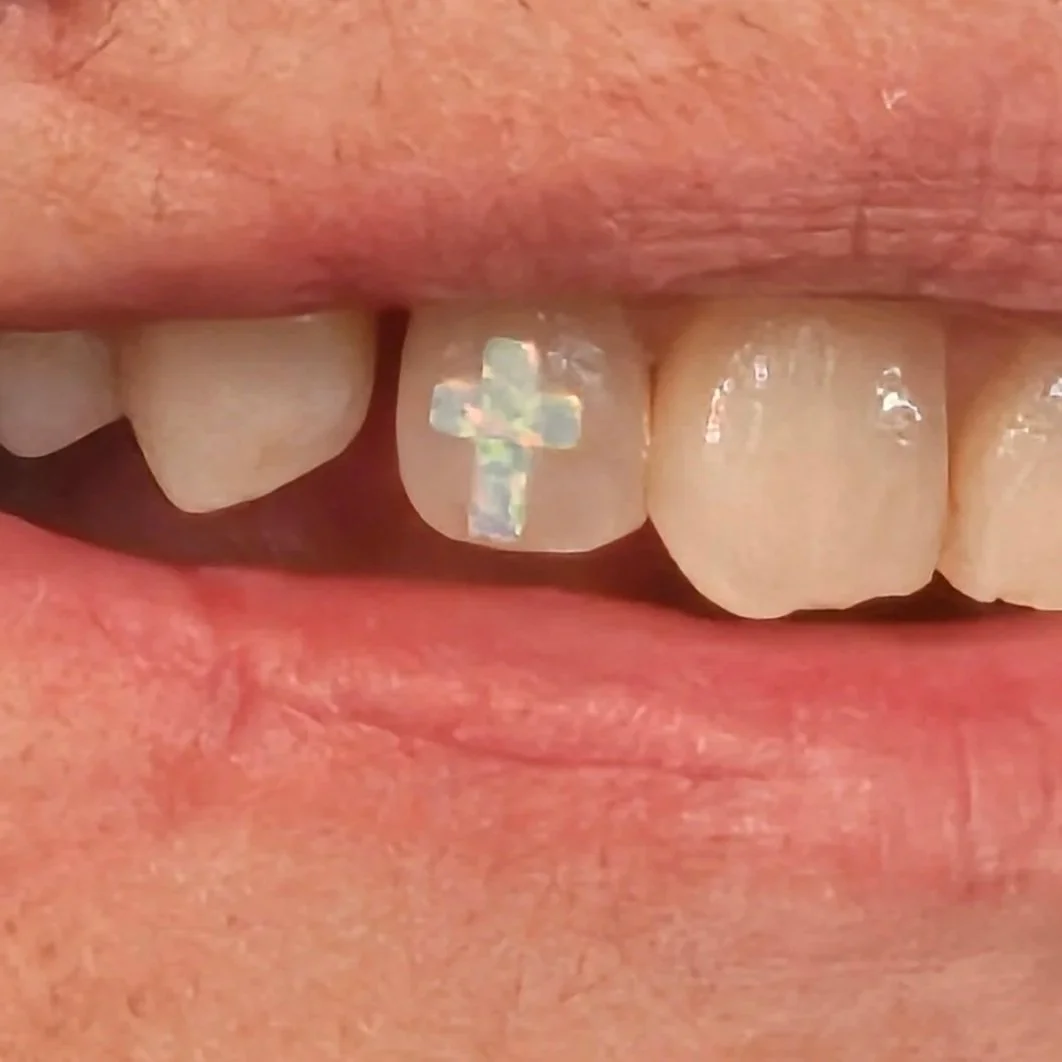 Close-up of teeth, with a decorative iridescent cross sticker on the front tooth.