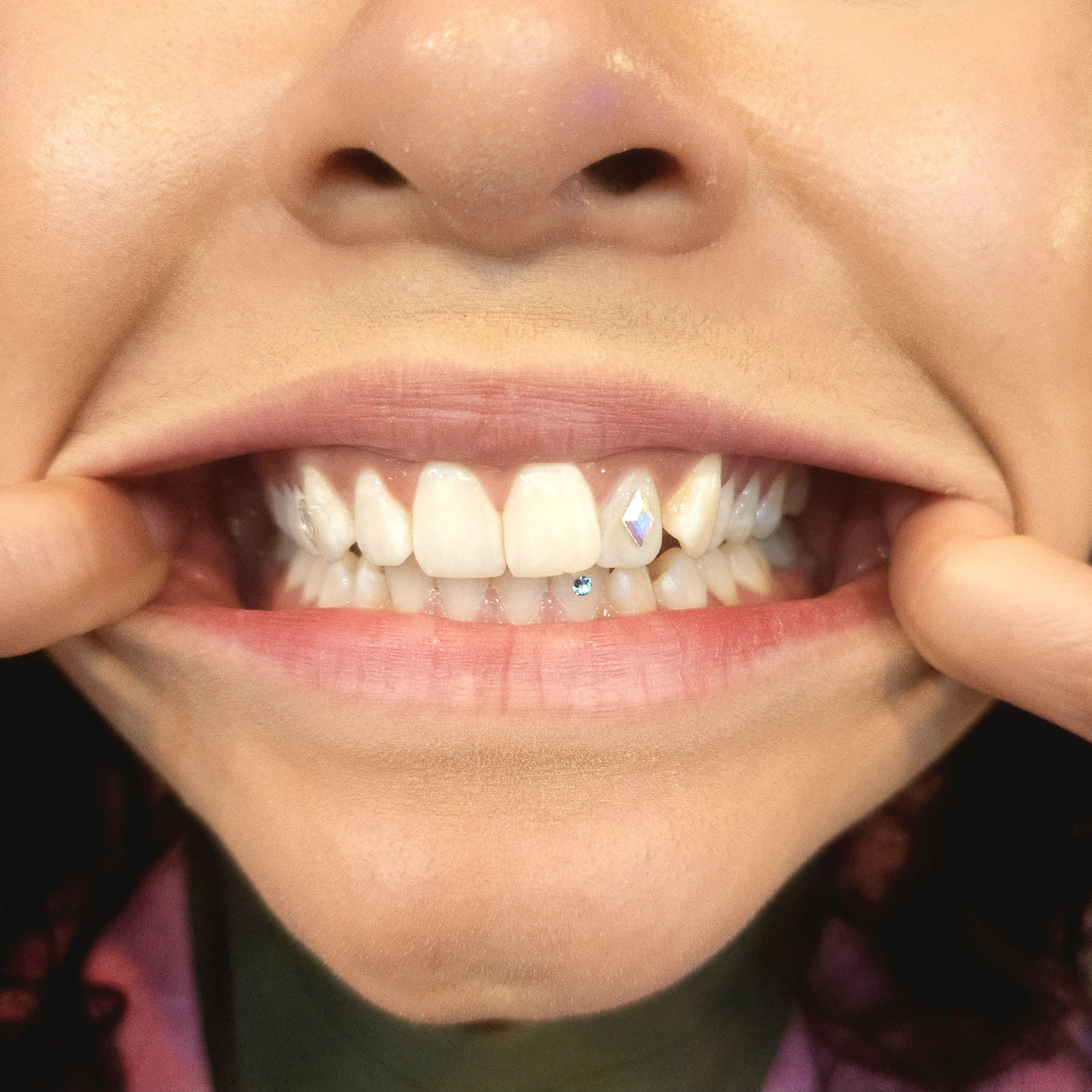 Person pulling lip to show upper and lower teeth with dental jewelry and colorful details.