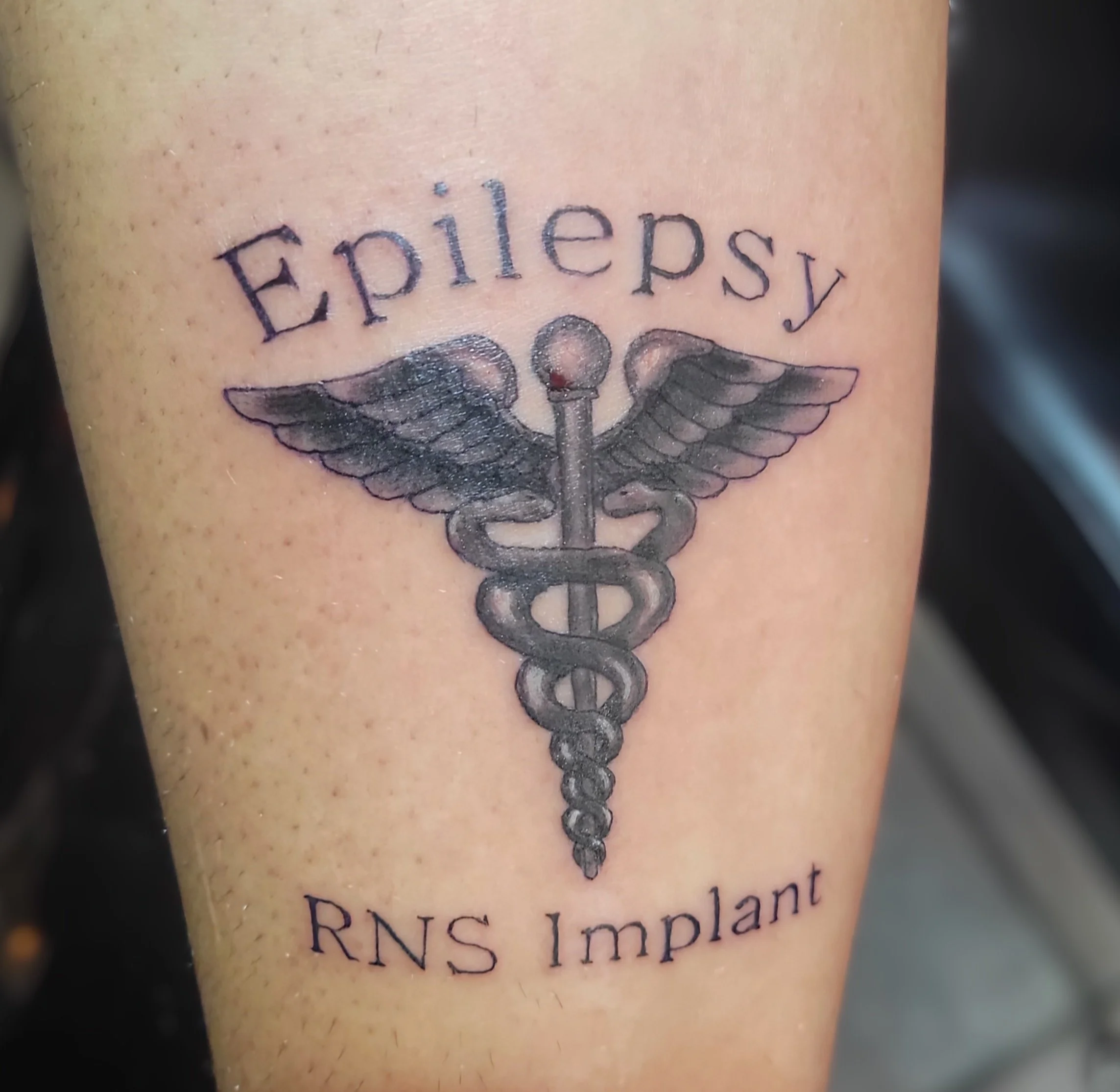 Tattoo of a medical caduceus with wings, the word 'Epilepsy' above, and 'RNS Implant' below.