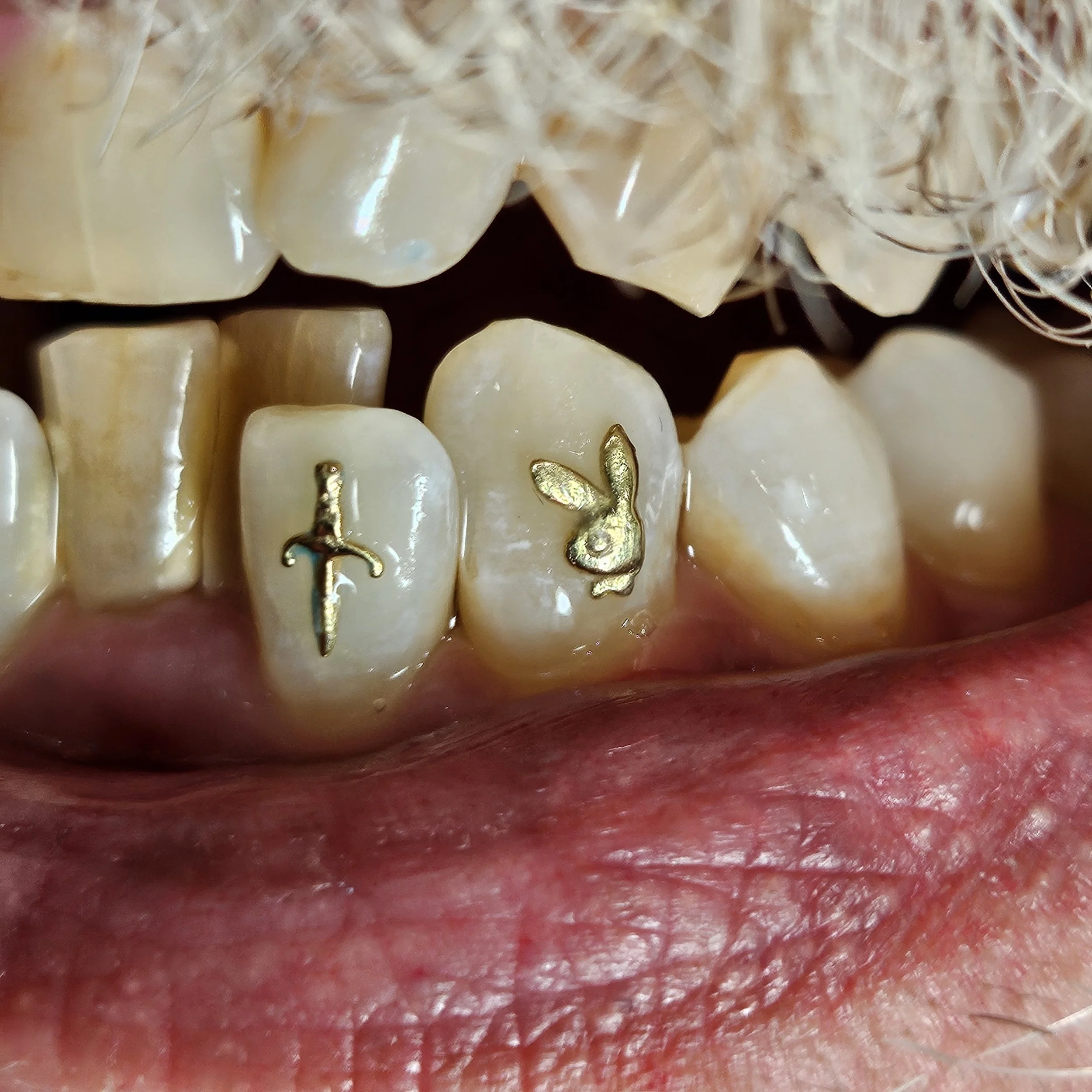 Close-up of human teeth with gold dental jewelry, including a cross and a bunny.