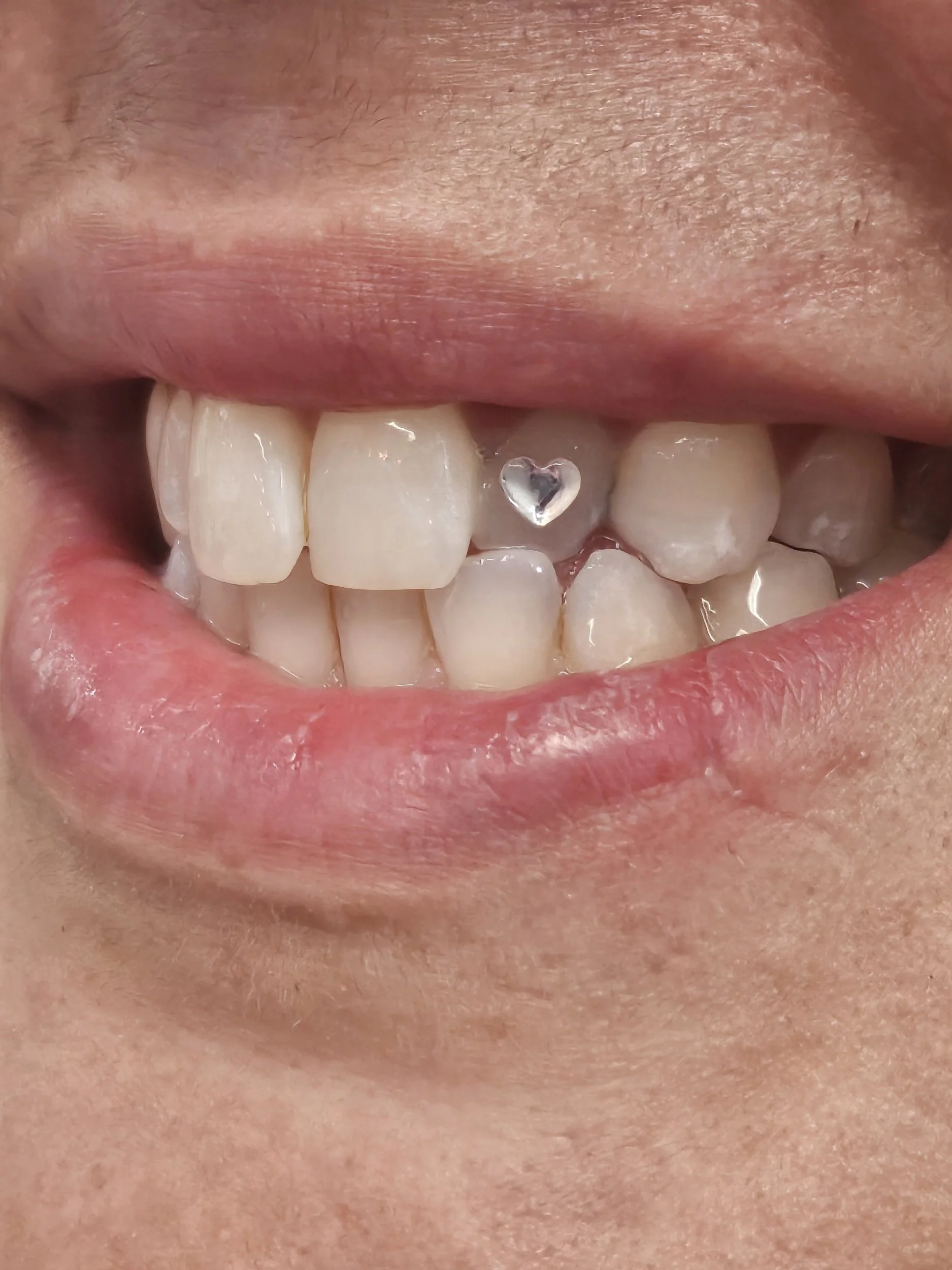 Close-up of a smile showing teeth with a small heart-shaped dental jewelry on one of the upper front teeth.