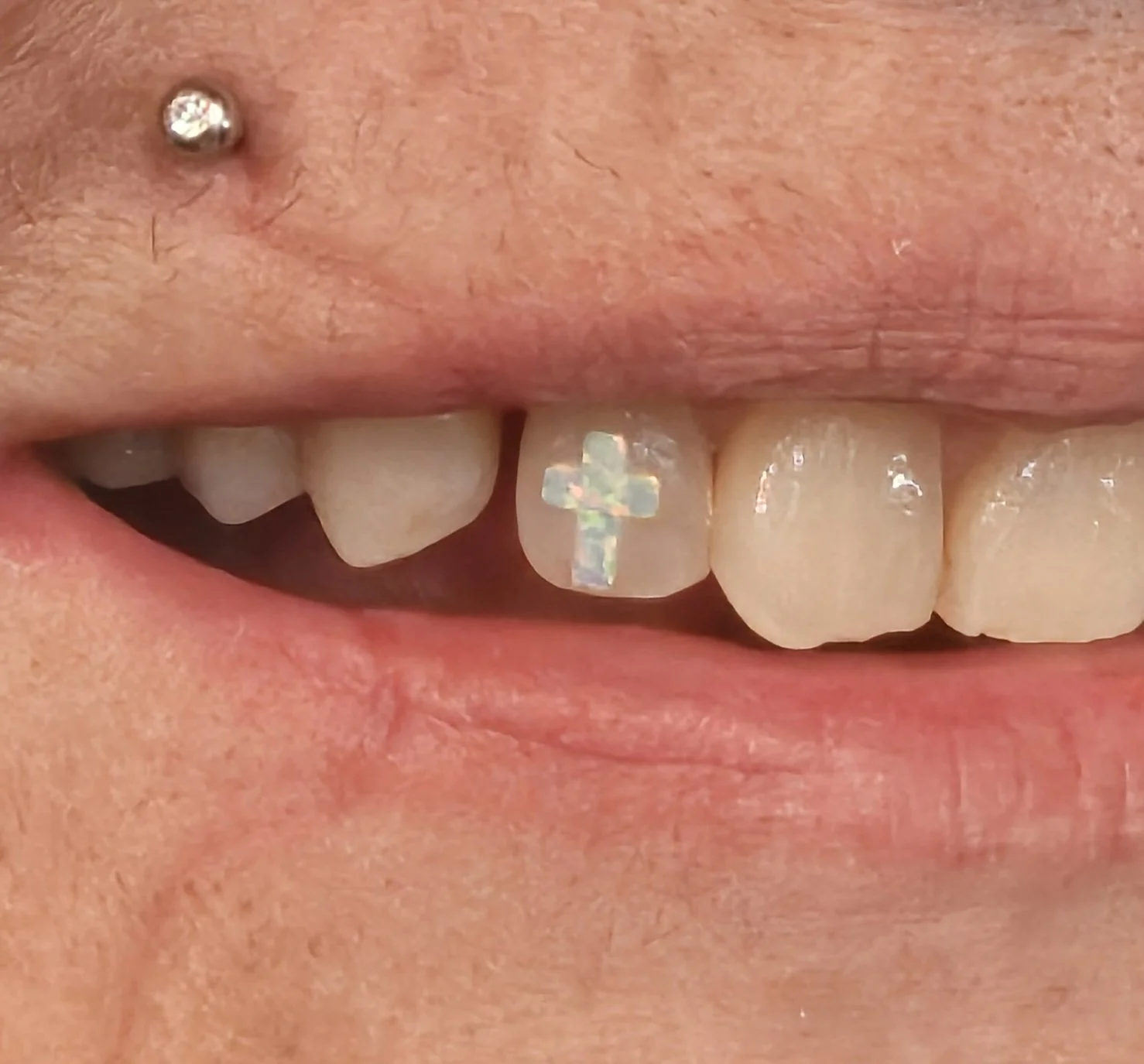 Close-up of a person's mouth with a small cross-shaped sticker on one tooth and a nose piercing with a small stone.