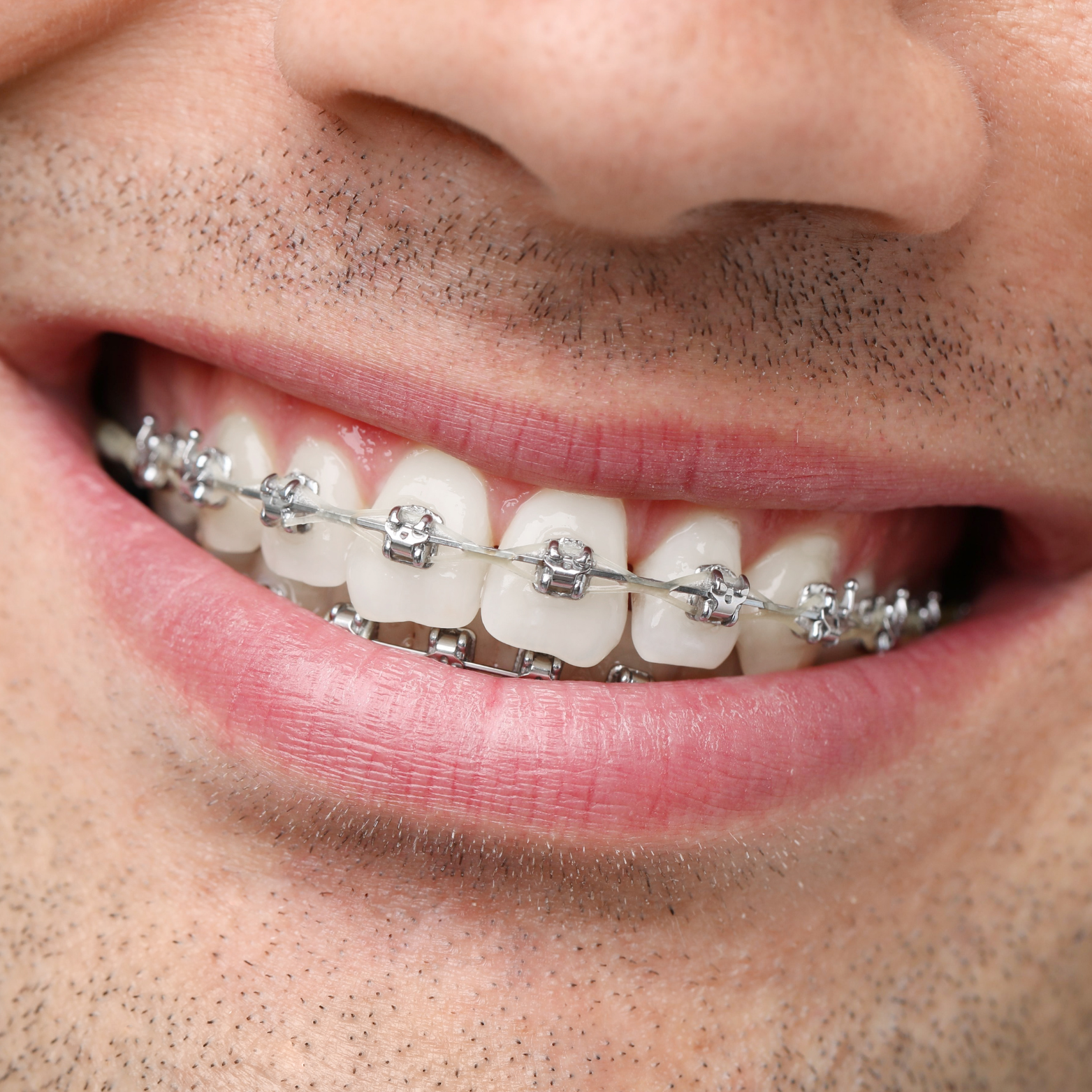 METAL BRACKET