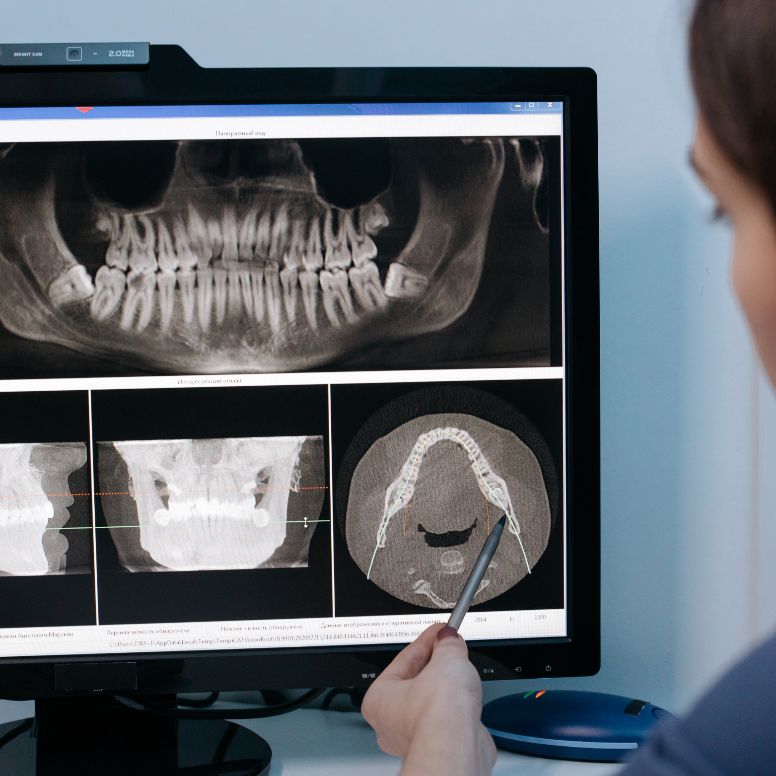 CBCT (3D X-RAY)