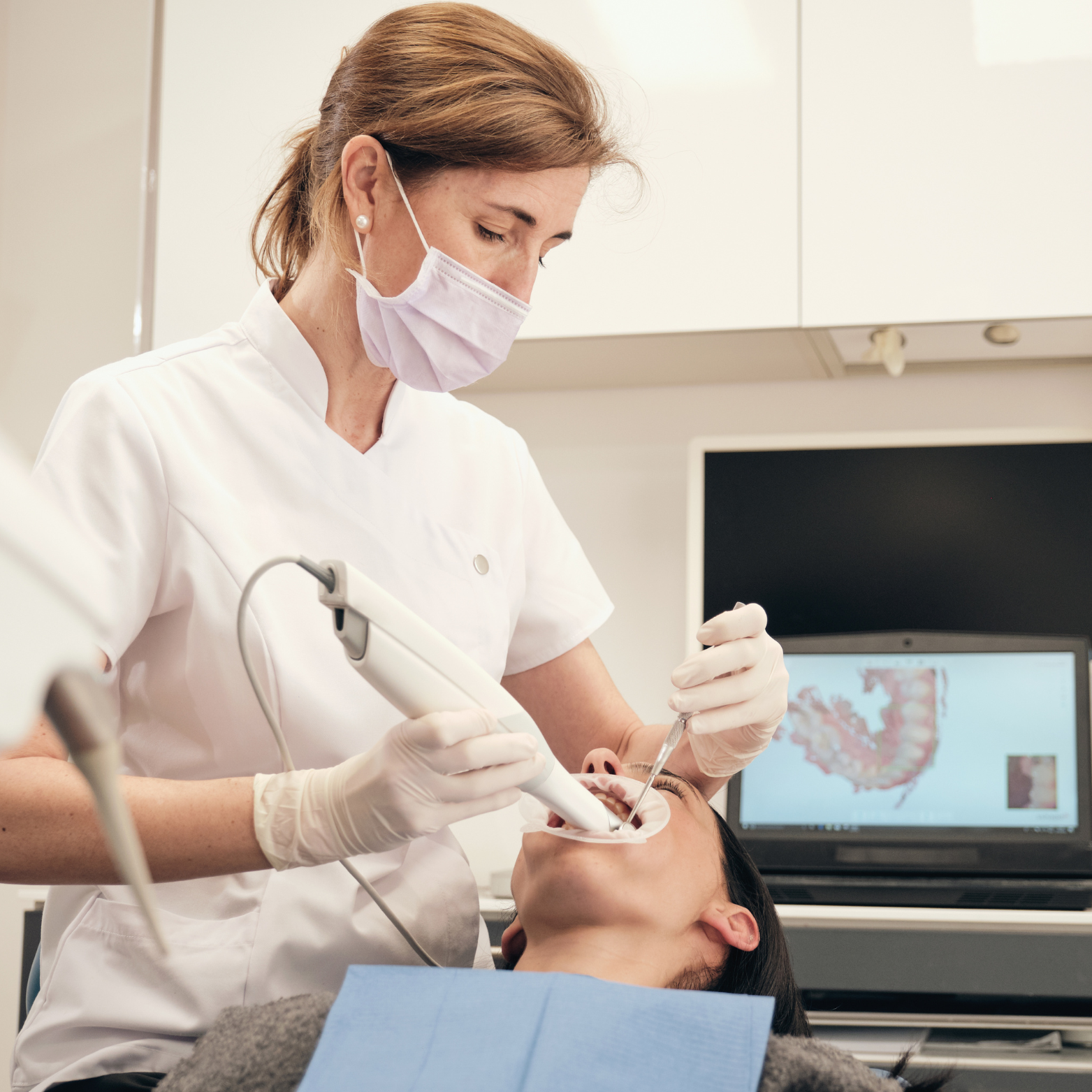 INTRAORAL SCANNER
