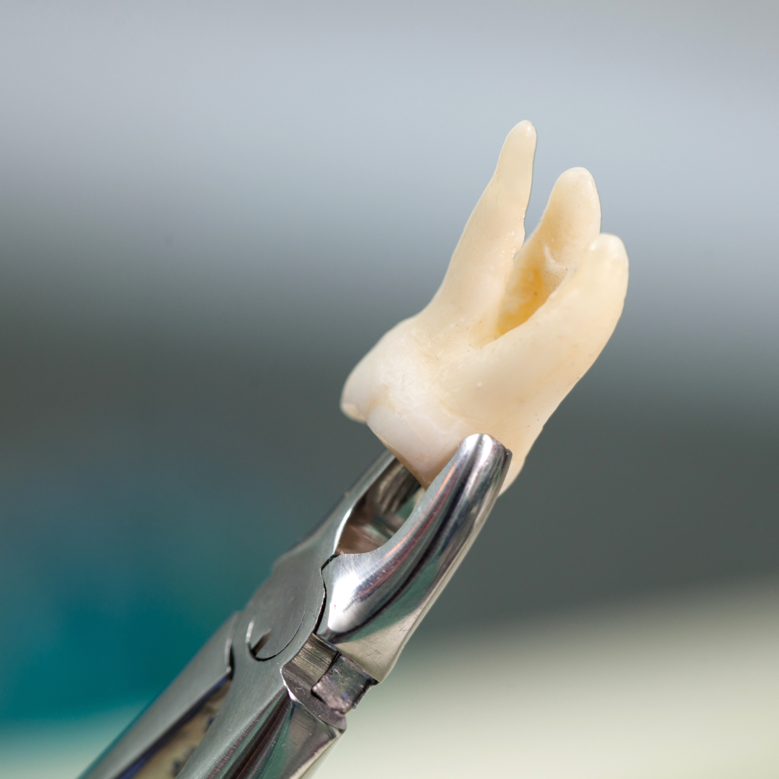 TOOTH EXTRACTION