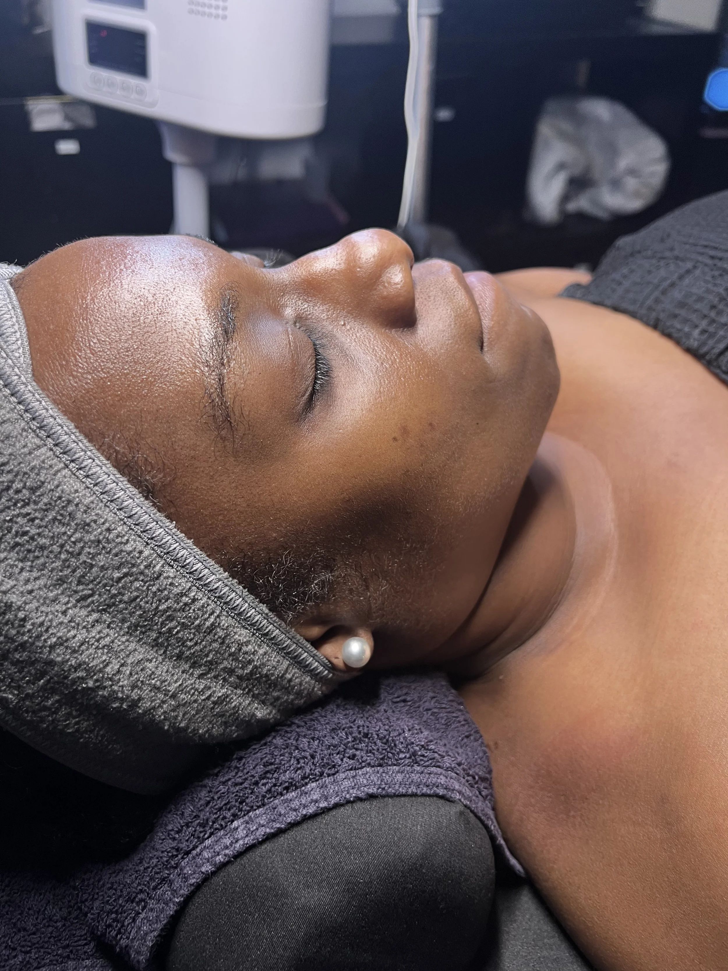 Stop Starting Over: How a Corrective Facial Routine Actually Clears Hyperpigmentation in Houston’s Heat – Skynvy Houston