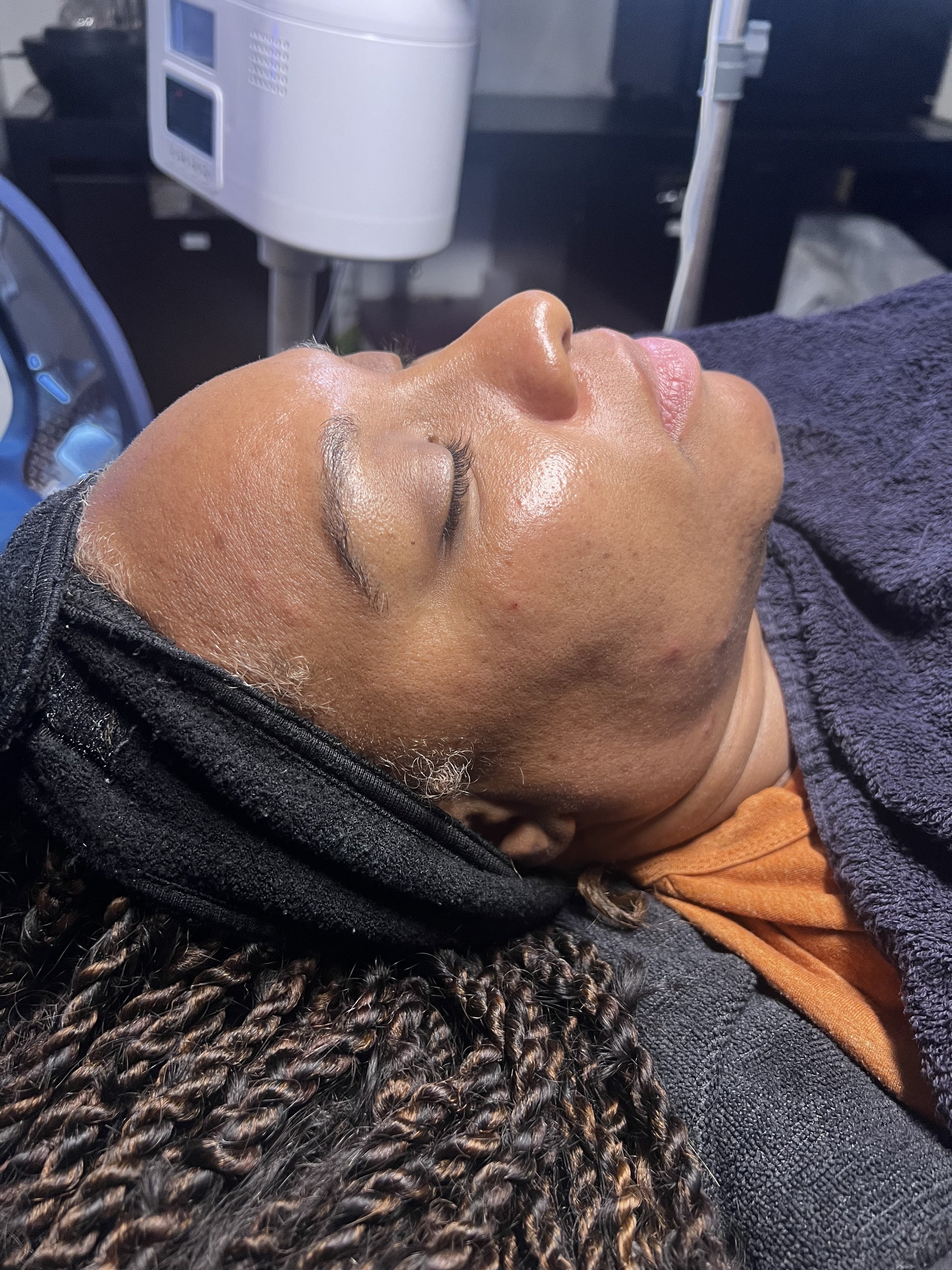 Winter Skincare for Black Skin in Houston: How to Fix Dry, Dull, Over-Exfoliated Skin with Skynvy Houston