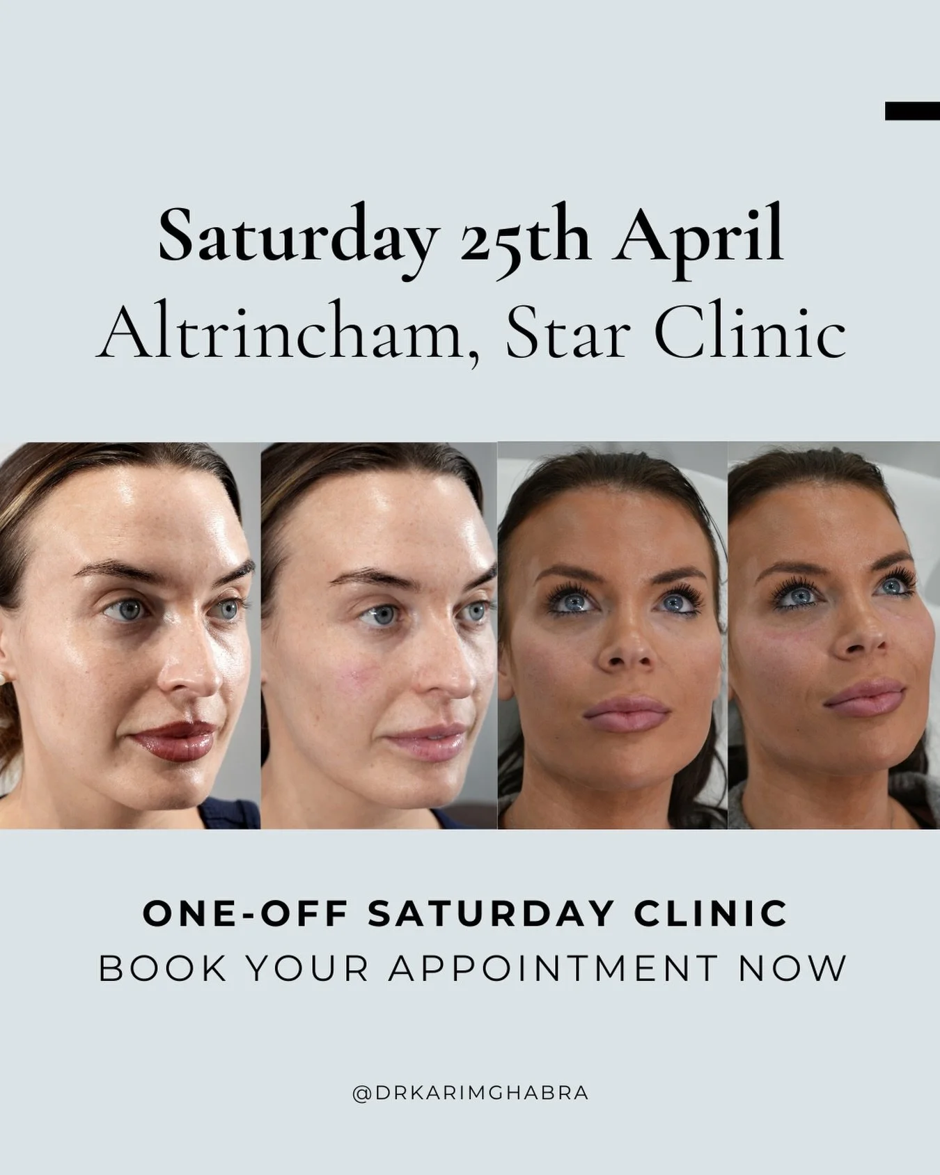 On Saturday 25th April I&rsquo;ll be offering appointments at @starclinicmanchester ✨

I usually only work there on Wednesdays, so if you&rsquo;ve been waiting for a Saturday slot, I strongly recommend booking now to avoid missing out. 

This is a on