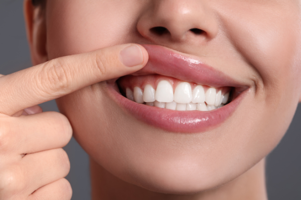 Close-up of a person's smile, showing white teeth, with one finger touching the upper lip.