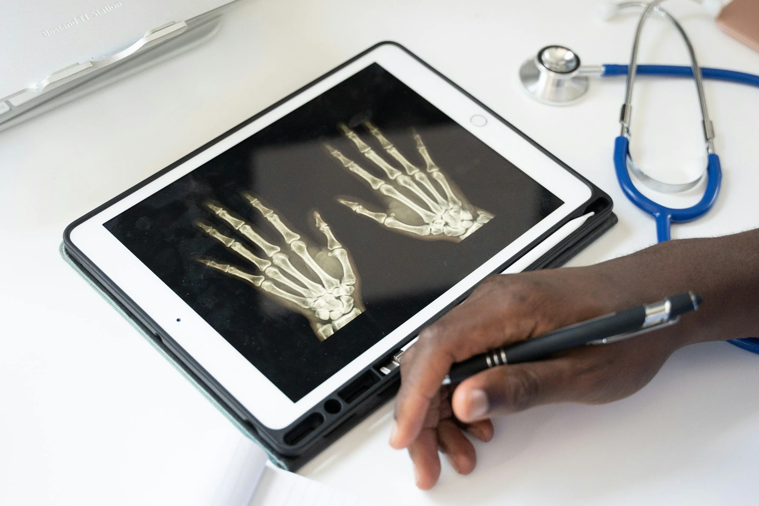 A person holding a stylus pointing at an X-ray image of two human hands on a tablet. A stethoscope is placed on the table next to the tablet.