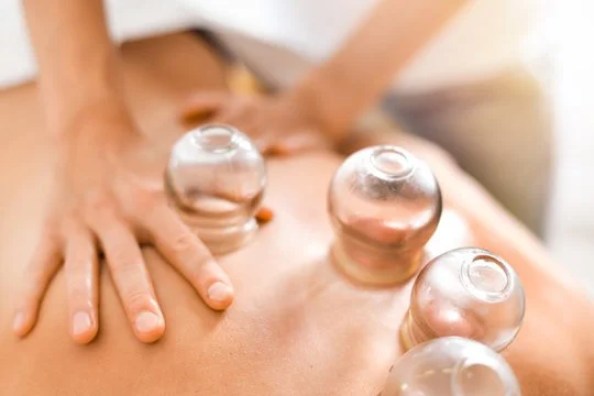 Therapeutic cupping therapy treatment to improve circulation and reduce muscle tension at The Nature of Health in Gilbert, AZ