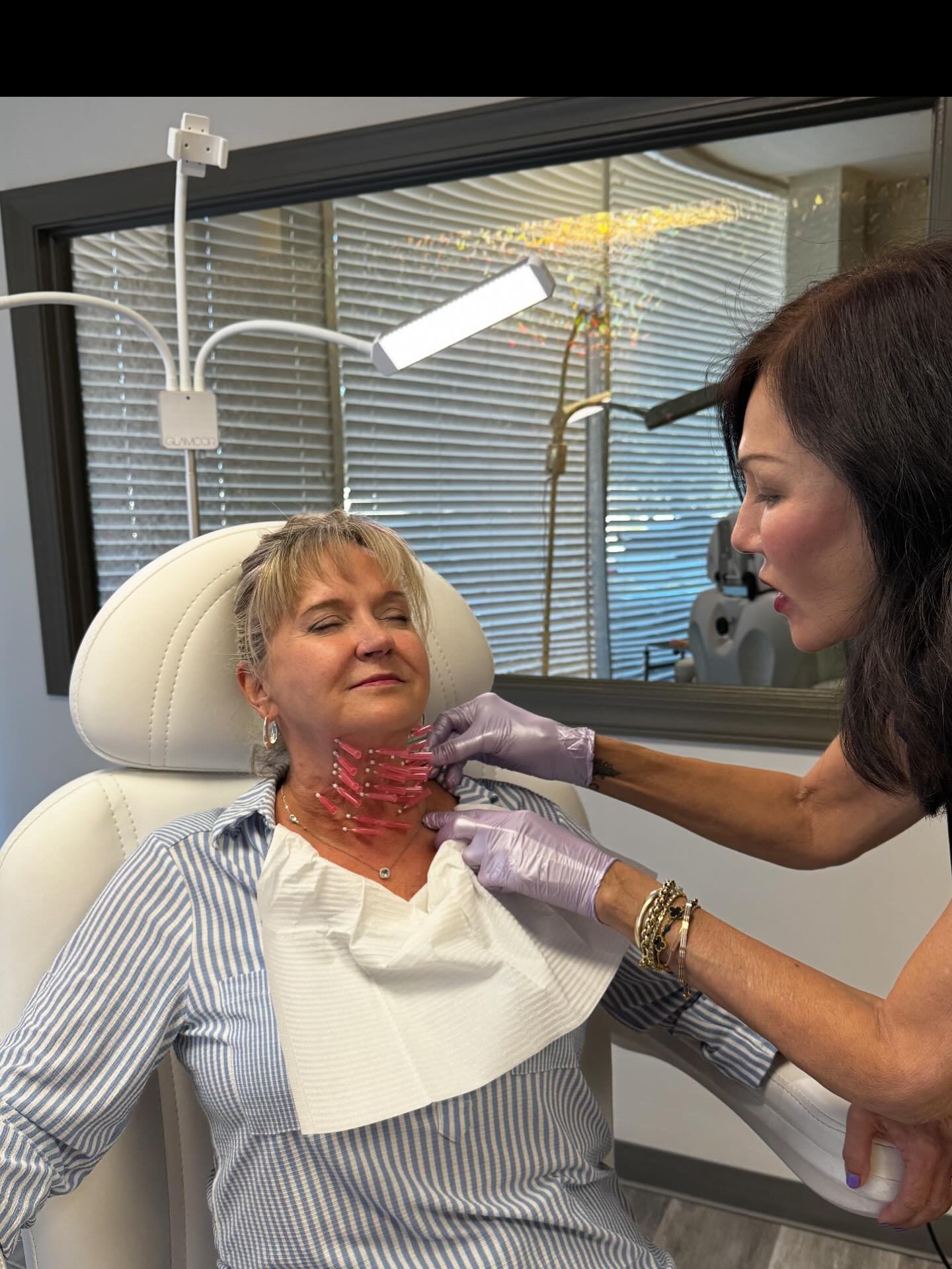 One of the most remarkable treatments we have at our fingertips. 
PLLA threads are FDA approved and safe for use in correcting fine lines and skin laxity. Common side effects are typically mild and temporary, such as bruising and swelling and sorenes