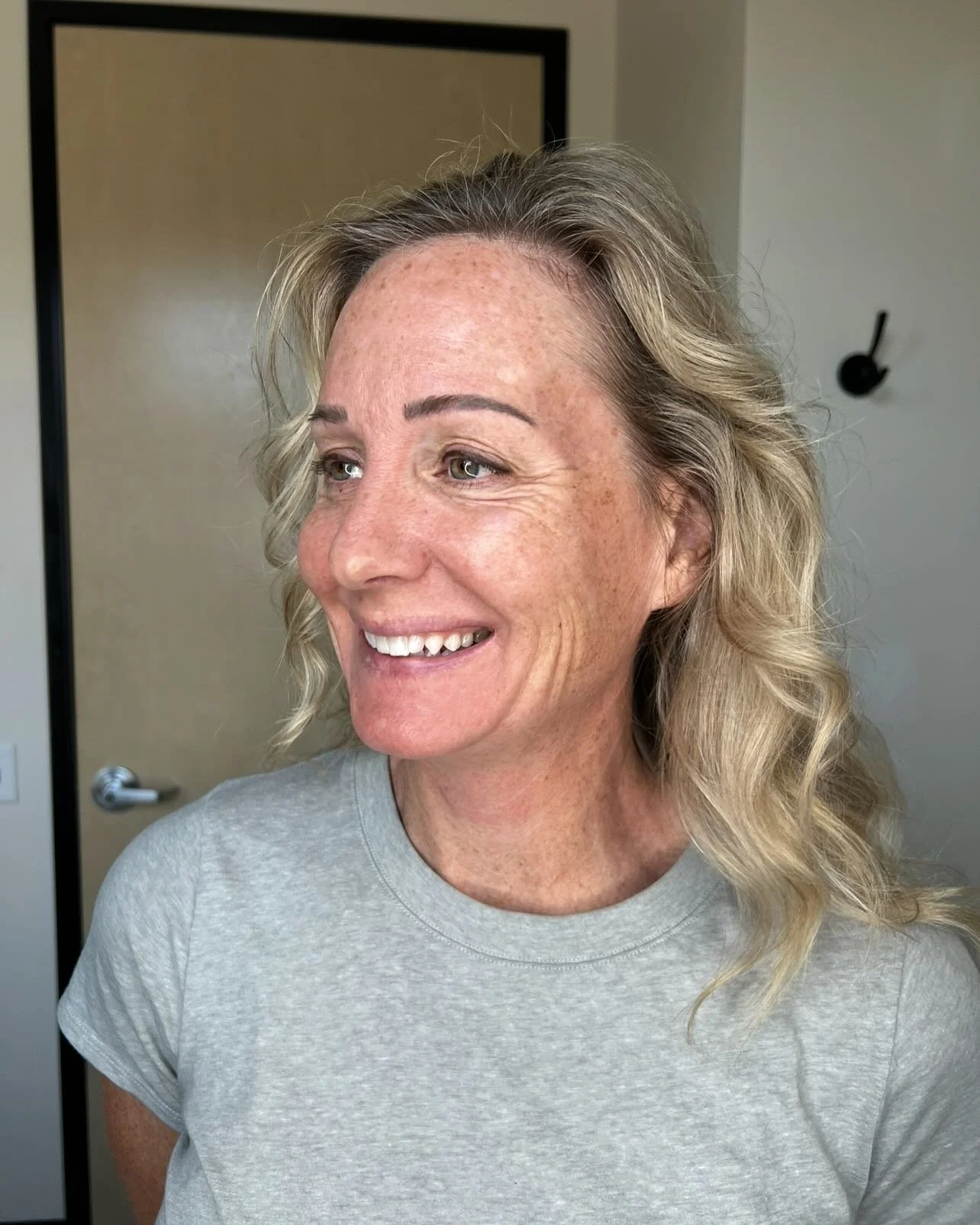 Some say Diamonds are a girls best friend but I say Collagen is! 💋 Swipe ➡️ to see this microneedling transformation immediately after the treatment.