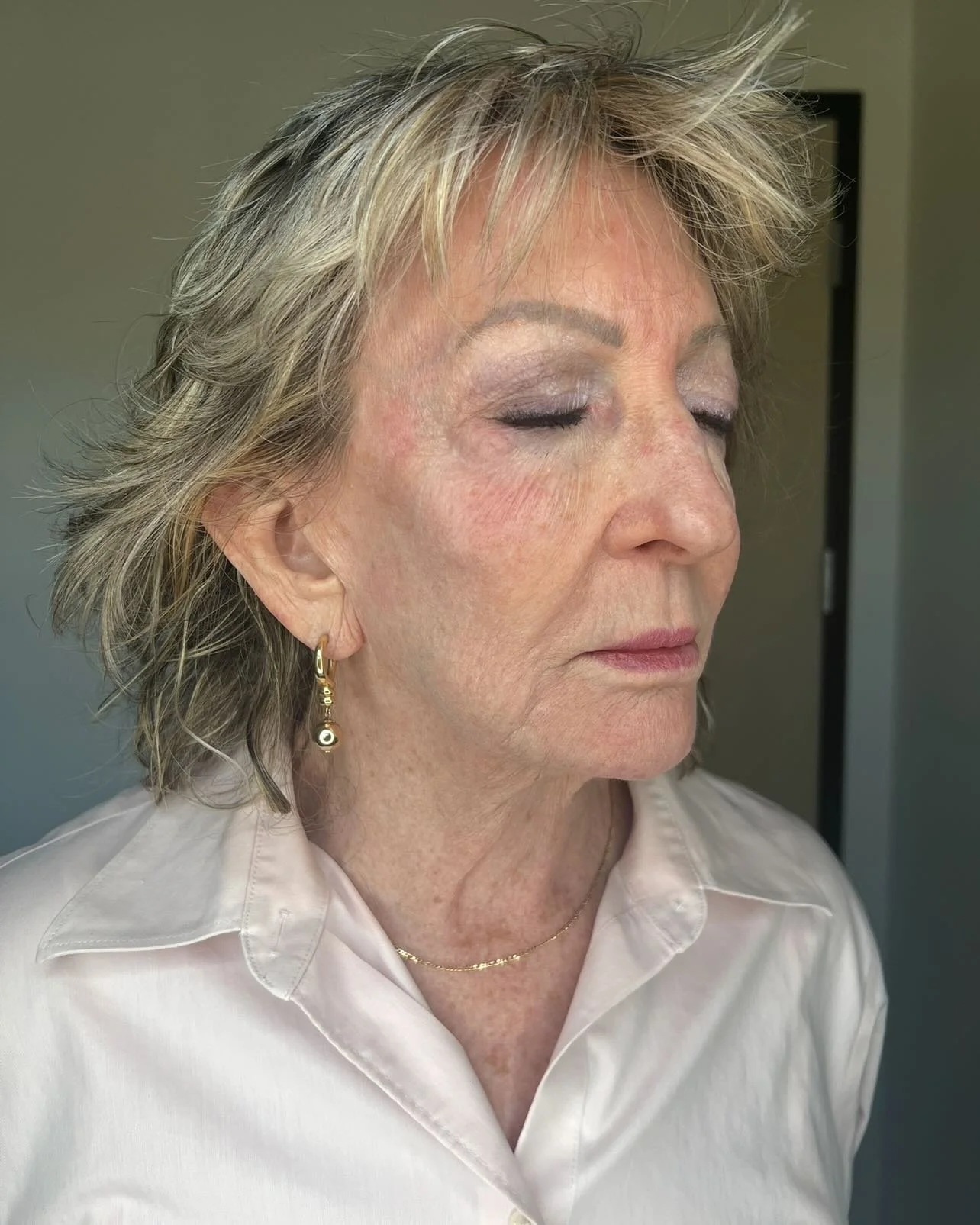 Microneedling before and immediately after ❤️&zwj;🔥