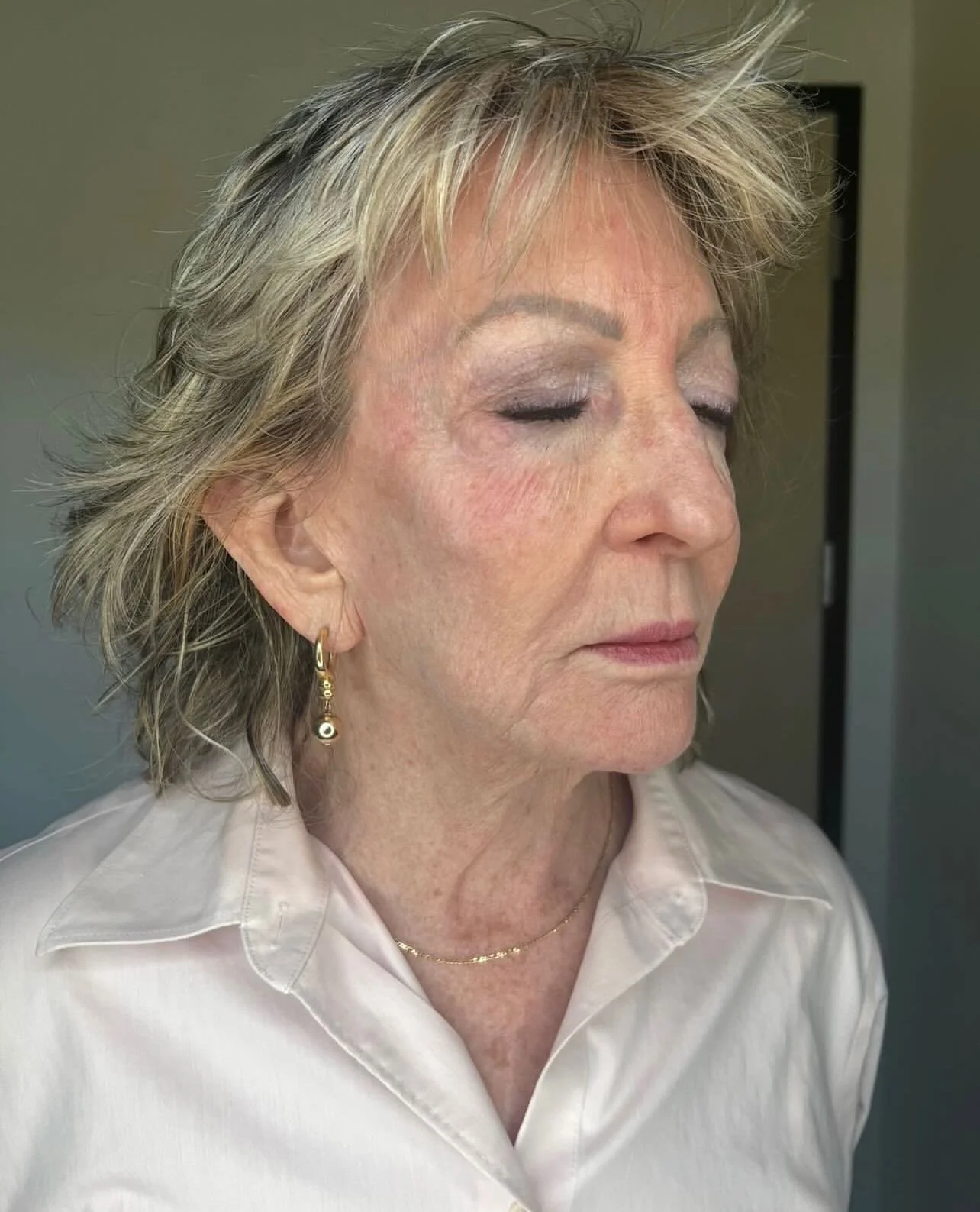 Microneedling before and immediately after ❤️&zwj;🔥

This is a collagen induction therapy (CIT) that creates micro channels in the skin producing many skin resurfacing benefits such as even skin tone &amp; texture, diminishes fine lines, wrinkles an