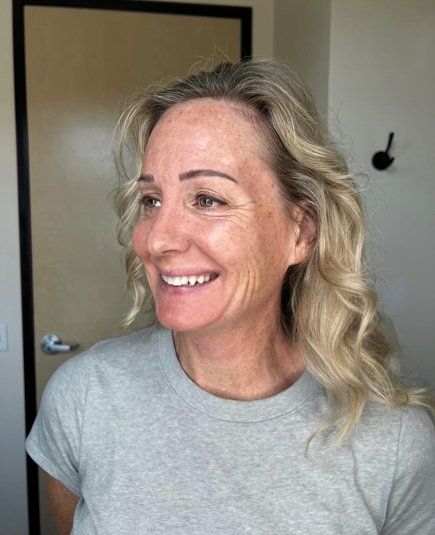 Cosmetic treatments that can stimulate collagen production and improve skin elasticity ⬇️

1. Microneedling
2. Radiofrequency (RF) Skin Tightening
3. Ultrasound Therapy
4. Laser Treatments
✨Fractional &amp; Non-Ablative Lasers
✨Laser Skin Tightening
