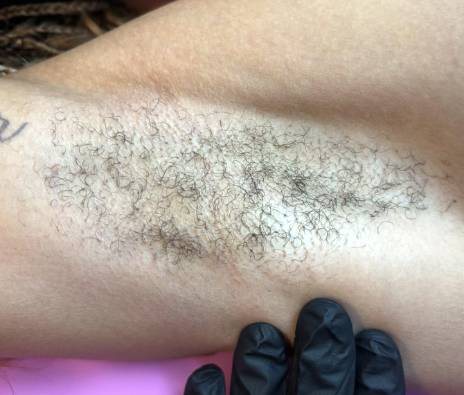 Close-up of a person's underarm with visible dark, curly hair being pulled with fingers wearing black gloves.