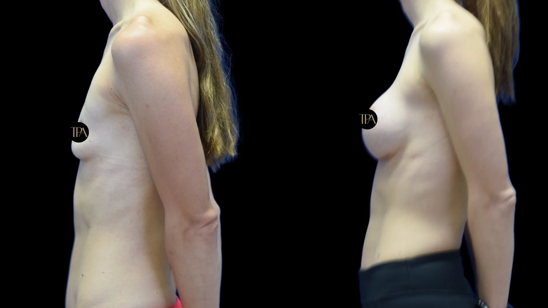 Side view of two topless women with long hair, facing opposite directions against a black background.