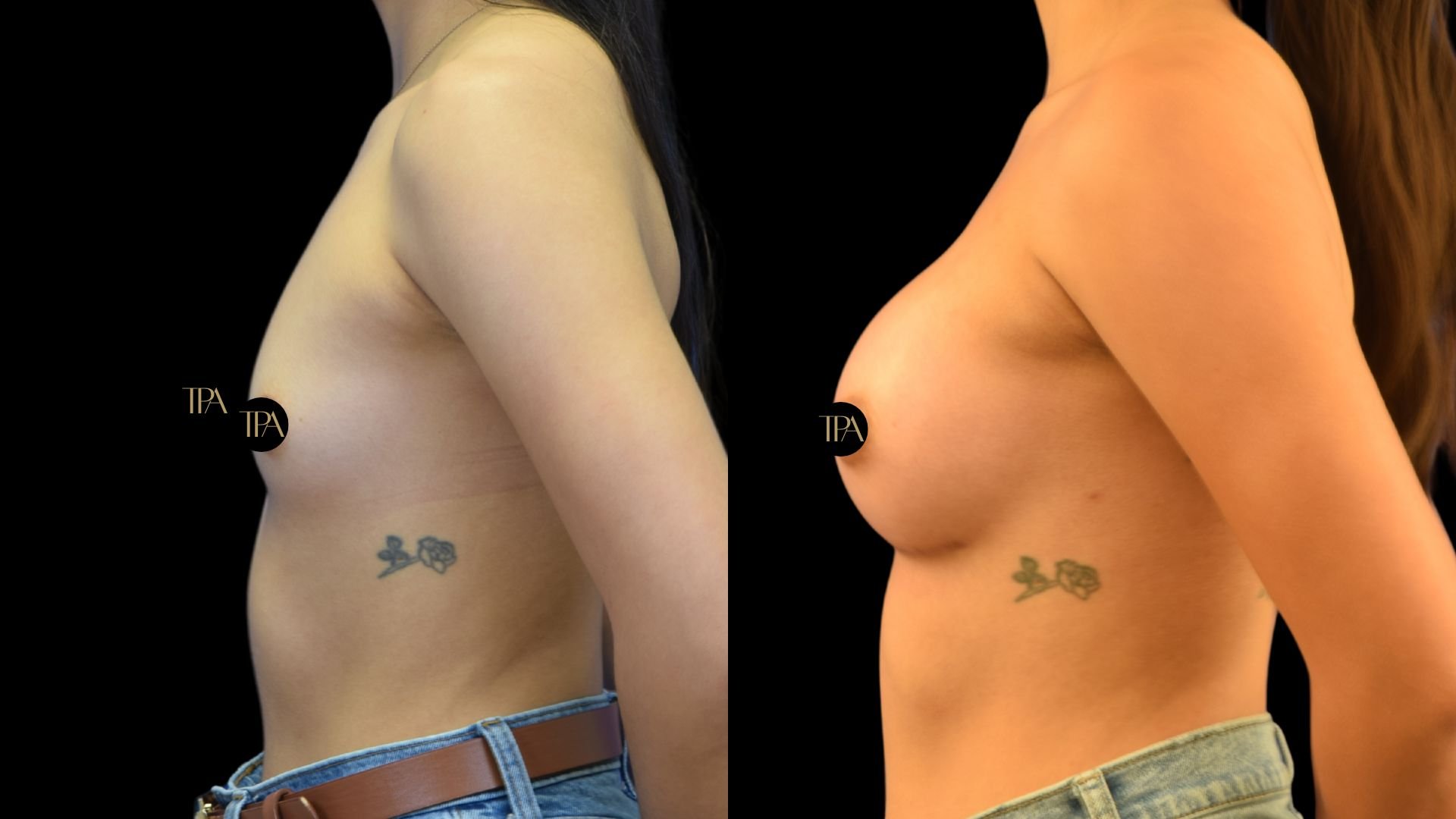 Side-by-side comparison of two women’s upper torsos with tattoos on their hips, both topless, wearing jeans, against a black background.