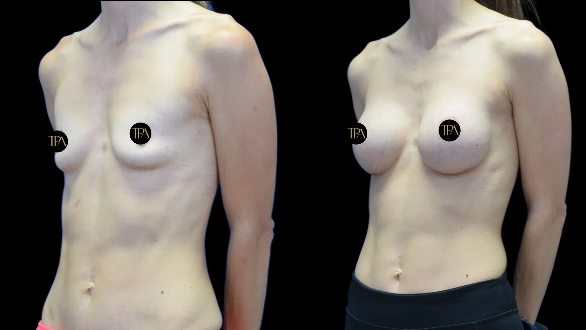 Two mannequins without heads displaying their torsos against a black background, with black circles covering their nipples that have the letters TPA.