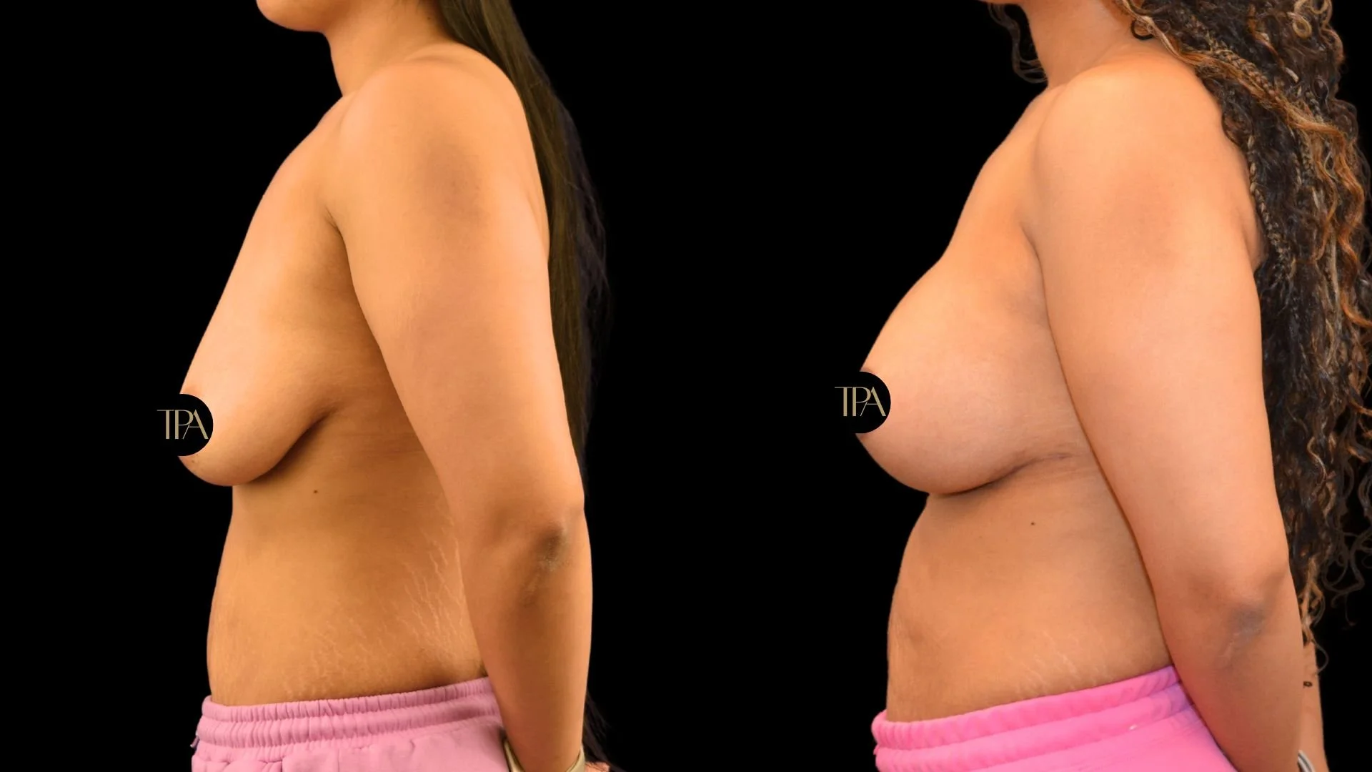 Side view of two women topless against a black background, wearing pink shorts, with their breasts partially visible and facing opposite directions.