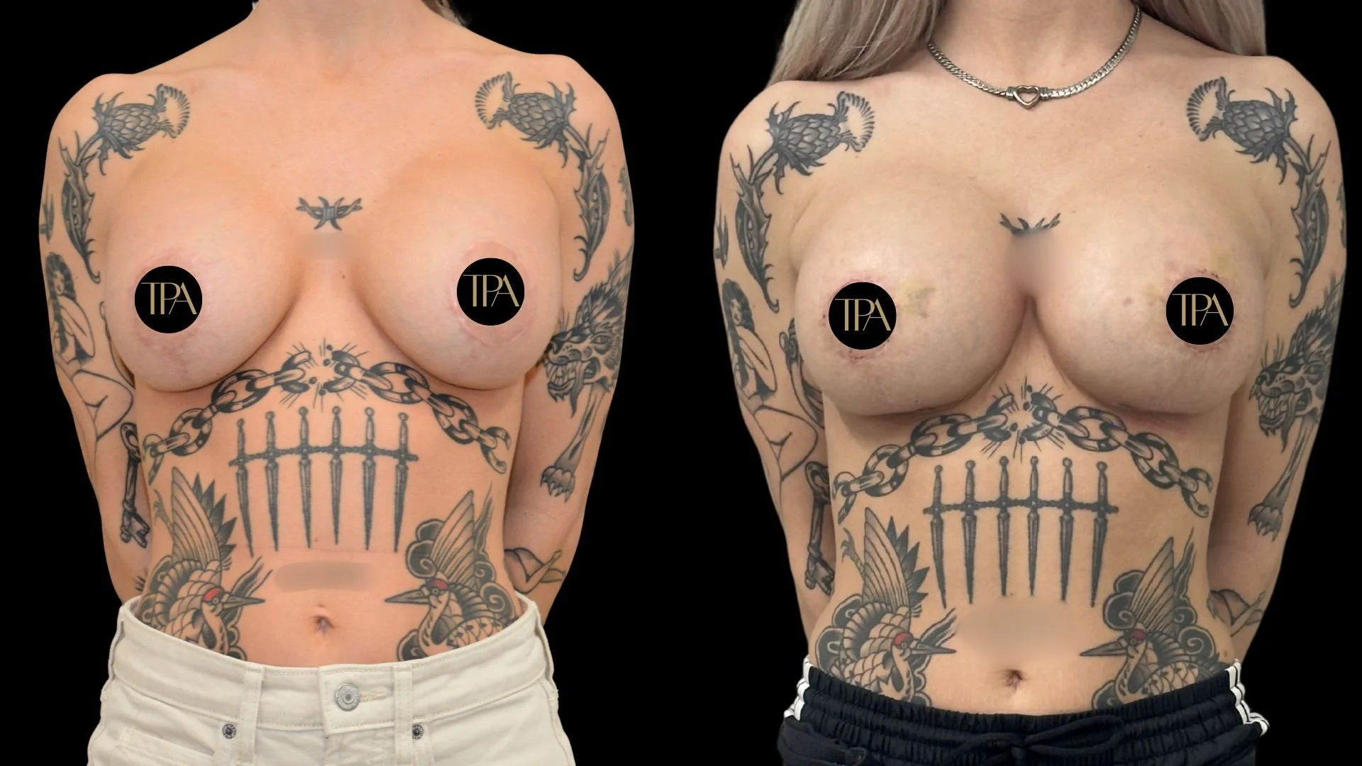Comparison of two women with tattoos on their upper bodies, showing their chests, shoulders, and stomachs against a black background.