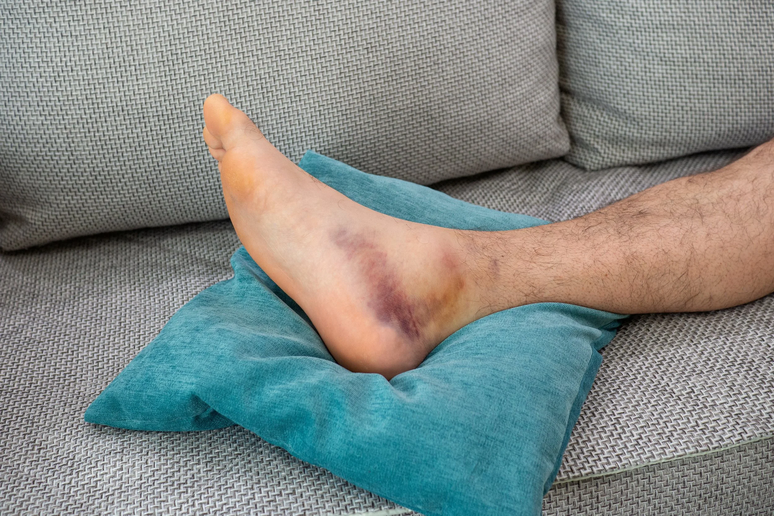 hakuba - acute injury management tips