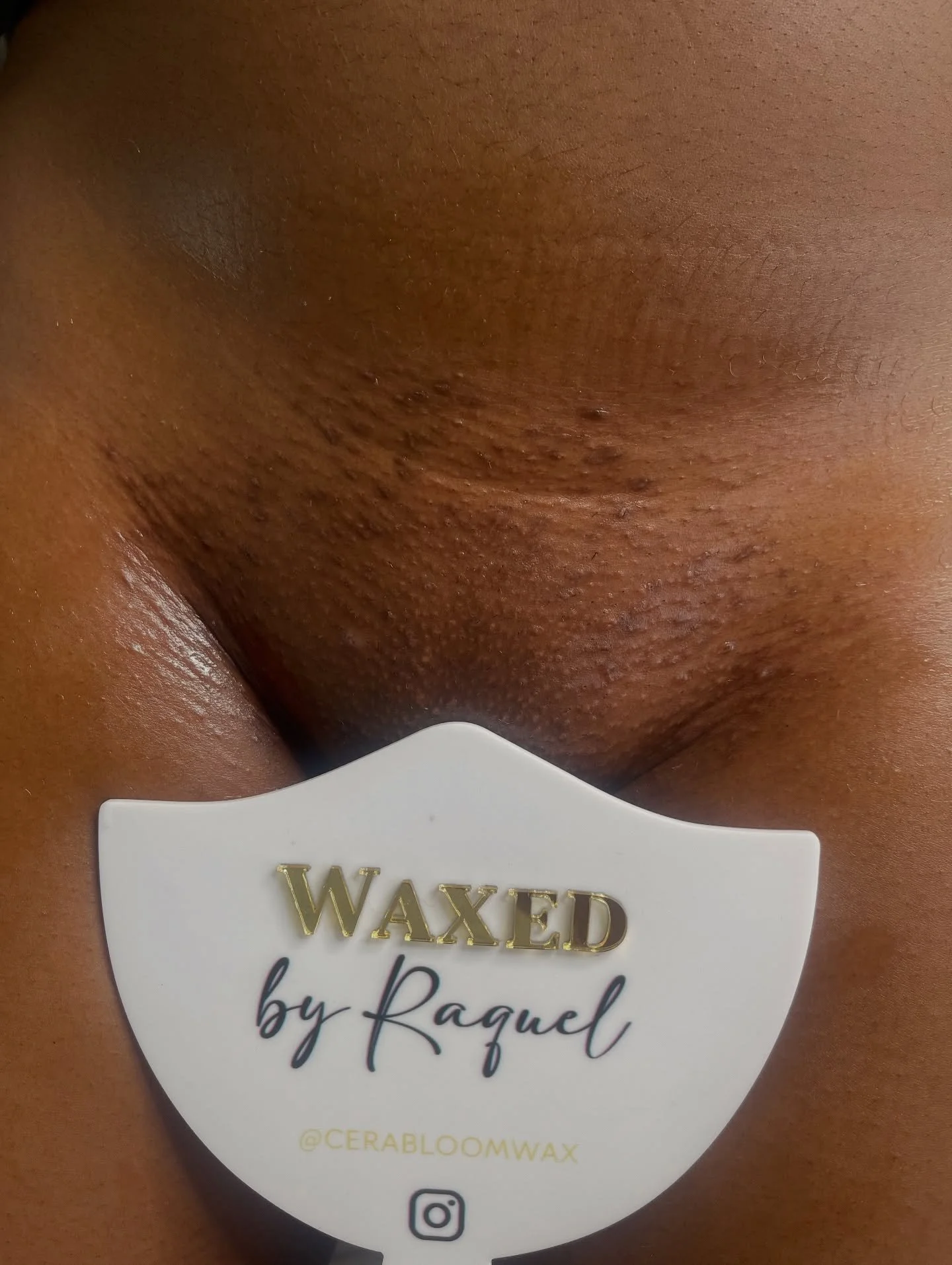 &ldquo;𝑾𝒉𝒂𝒕 𝒄𝒂𝒏 𝑰 𝒆𝒙𝒑𝒆𝒄𝒕 𝒂𝒇𝒕𝒆𝒓 𝒕𝒓𝒂𝒏𝒔𝒊𝒕𝒊𝒐𝒏𝒊𝒏𝒈 𝒕𝒐 𝒘𝒂𝒙𝒊𝒏𝒈?&rdquo; 📝

This is a 𝒓𝒆𝒂𝒍𝒊𝒔𝒕𝒊𝒄 wax result after months of shaving.

When you shave:
&bull; 𝐇𝐚𝐢𝐫 𝐠𝐫𝐨𝐰𝐬 𝐢𝐧 𝐝𝐢𝐟𝐟𝐞𝐫𝐞𝐧𝐭 𝐜𝐲𝐜𝐥𝐞