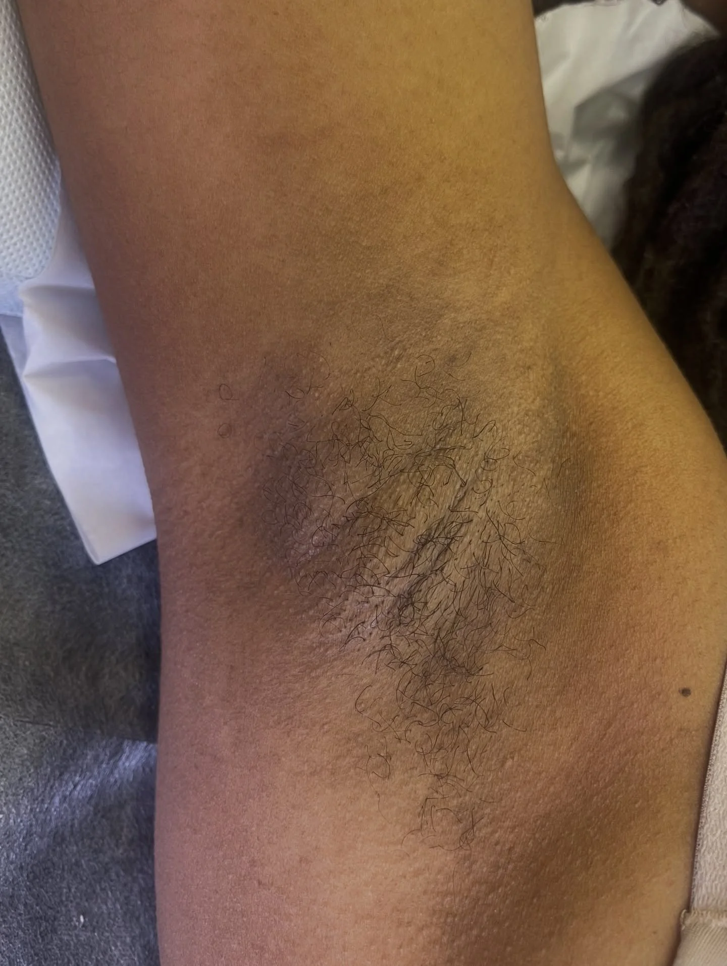 𝑭𝒓𝒆𝒔𝒉 𝑷𝒊𝒕𝒔 ✨

Shaving causes hair to grow back blunt and in multiple directions, which can lead to irritation, shadowing, and stubborn regrowth.

Using @blackcoralwaxuk 𝑷𝒍𝒖𝒎𝒆𝒓𝒊𝒂 𝑾𝒂𝒙, we&rsquo;re able to grip even the shortest and 