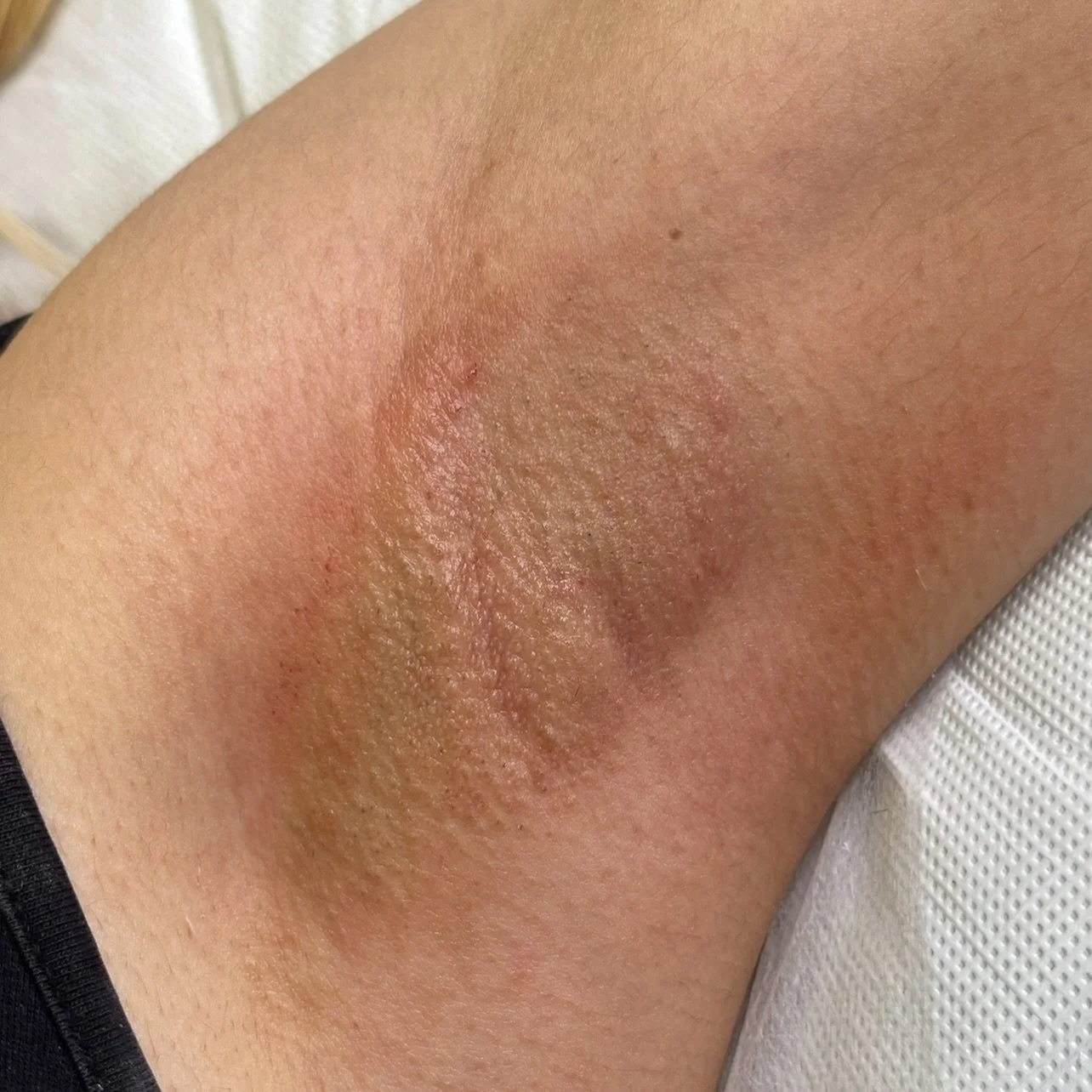 𝐒𝐦𝐨𝐨𝐭𝐡 𝐮𝐧𝐝𝐞𝐫𝐚𝐫𝐦𝐬 𝐣𝐮𝐬𝐭 𝐡𝐢𝐭 𝐝𝐢𝐟𝐟𝐞𝐫𝐞𝐧𝐭 💅🏽

📍 𝐁𝐢𝐫𝐦𝐢𝐧𝐠𝐡𝐚𝐦 𝐂𝐢𝐭𝐲 𝐂𝐞𝐧𝐭𝐫𝐞

𝐅𝐨𝐥𝐥𝐨𝐰 @cerabloomwax 🥚🤍.