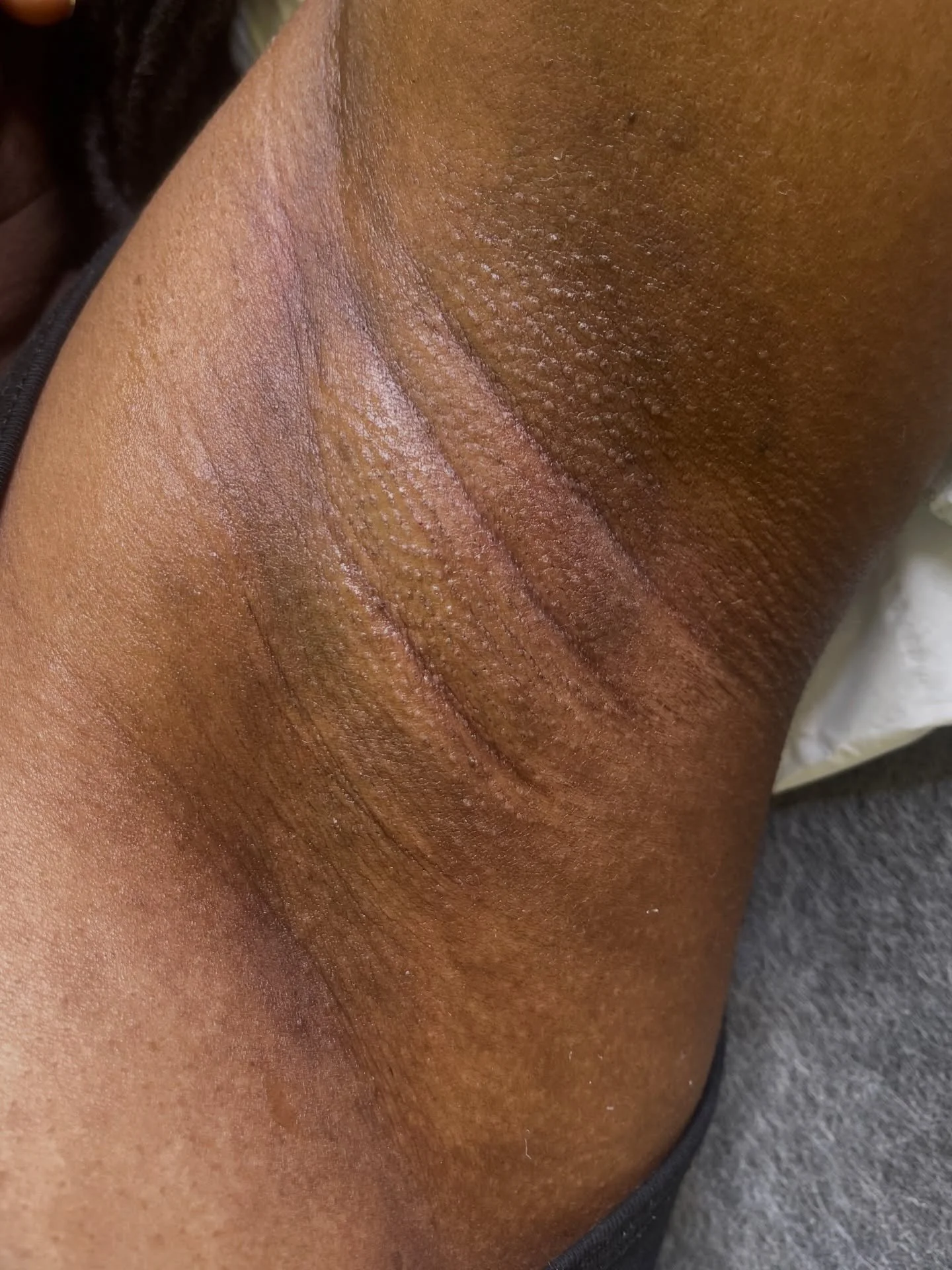 𝐒𝐰𝐢𝐩𝐞 𝐟𝐨𝐫 𝐭𝐡𝐞 𝐛𝐞𝐟𝐨𝐫𝐞&hellip;👀✨
𝐒𝐦𝐨𝐨𝐭𝐡 𝐮𝐧𝐝𝐞𝐫𝐚𝐫𝐦𝐬 𝐣𝐮𝐬𝐭 𝐡𝐢𝐭 𝐝𝐢𝐟𝐟𝐞𝐫𝐞𝐧𝐭 💅🏽

✨ 𝐔𝐧𝐝𝐞𝐫𝐚𝐫𝐦 𝐖𝐚𝐱𝐢𝐧𝐠 𝐟𝐫𝐨𝐦 &pound;𝟏𝟐✨
📍 𝐁𝐢𝐫𝐦𝐢𝐧𝐠𝐡𝐚𝐦 𝐂𝐢𝐭𝐲 𝐂𝐞𝐧𝐭𝐫𝐞
📲 𝐁𝐨𝐨𝐤 𝐯𝐢𝐚 𝐭𝐡𝐞 𝐥