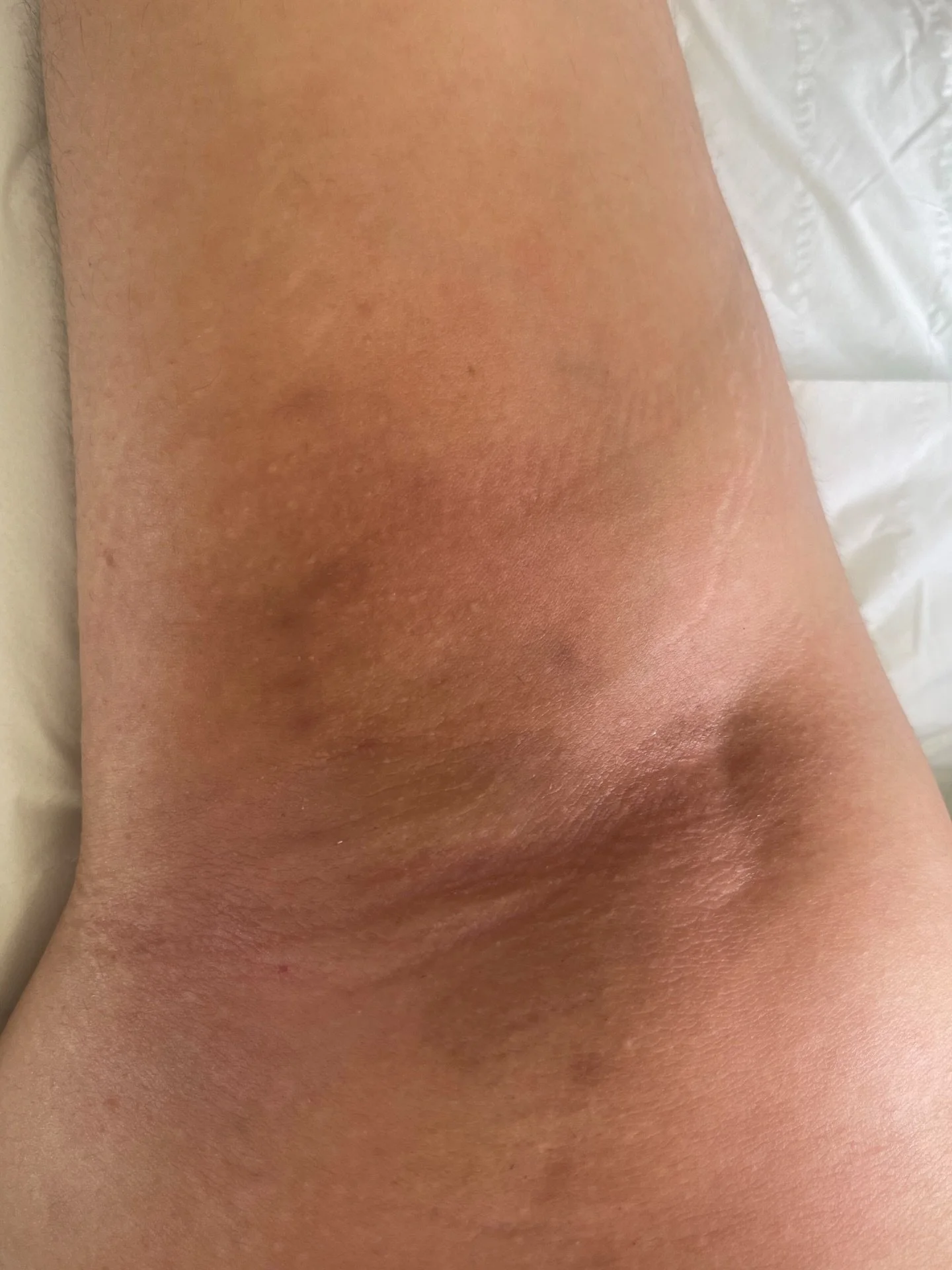 𝐍𝐨 𝐬𝐞𝐜𝐨𝐧𝐝 𝐭𝐡𝐨𝐮𝐠𝐡𝐭𝐬 𝐰𝐡𝐞𝐧 𝐢𝐭&rsquo;𝐬 𝐭𝐢𝐦𝐞 𝐭𝐨 𝐥𝐢𝐟𝐭 𝐲𝐨𝐮𝐫 𝐚𝐫𝐦𝐬😝

✨𝐔𝐧𝐝𝐞𝐫𝐚𝐦 𝐖𝐚𝐱𝐢𝐧𝐠 𝐟𝐫𝐨𝐦 &pound;𝟏𝟐✨
📍𝐁𝐡𝐚𝐦 𝐂𝐢𝐭𝐲 𝐂𝐞𝐧𝐭𝐫𝐞

𝐅𝐨𝐥𝐥𝐨𝐰 @cerabloomwax 💌
-
-
-
#womenswaxing #underarm #wa