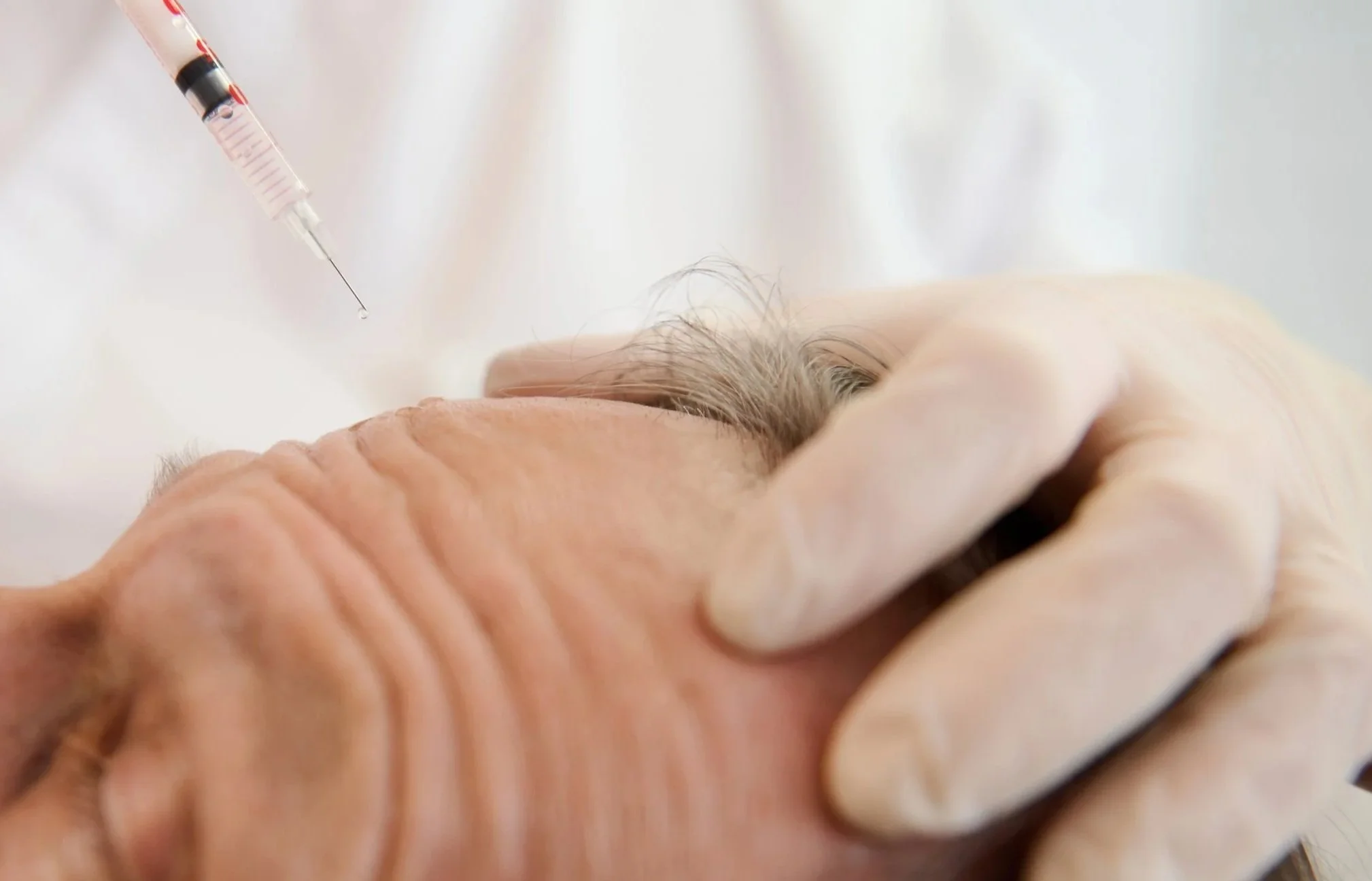 Anti-wrinkle-treatment-for-me-aesculus-clinic