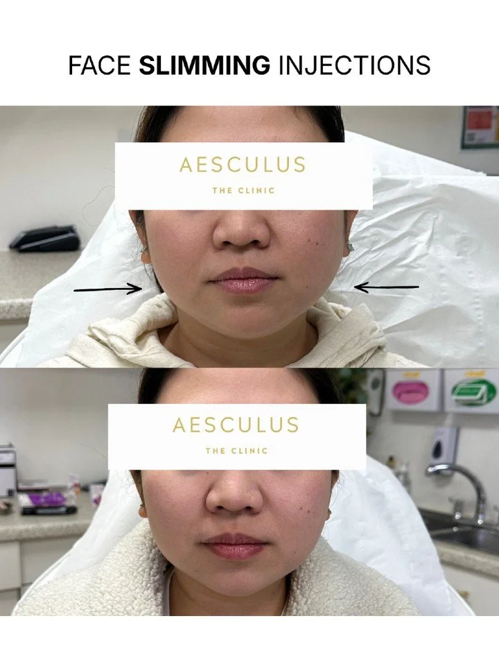 Available at our New Malden and Knightsbridge clinics!

Book your consultation online.

Aesculus Clinic | Medical Aesthetics New Malden | Skin Clinic New Malden
