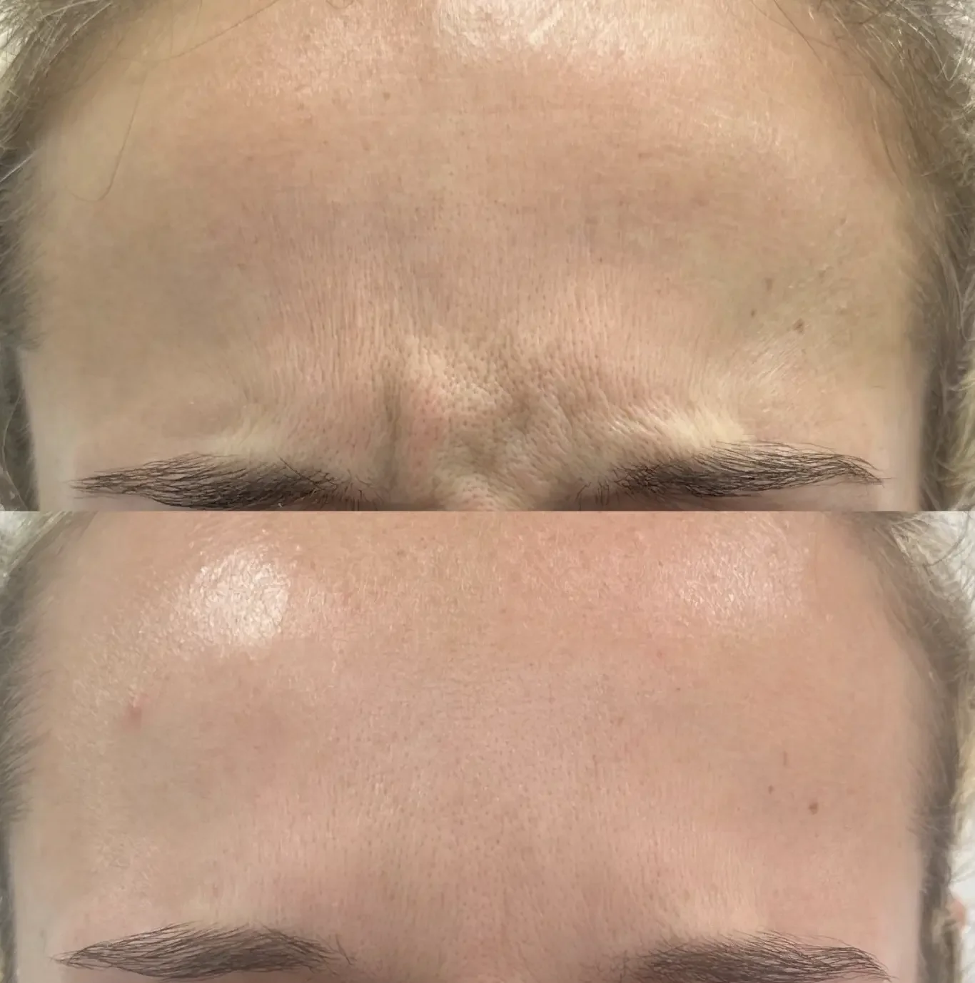 Anti-Wrinkle Treatments: Common Questions, Expert Answers