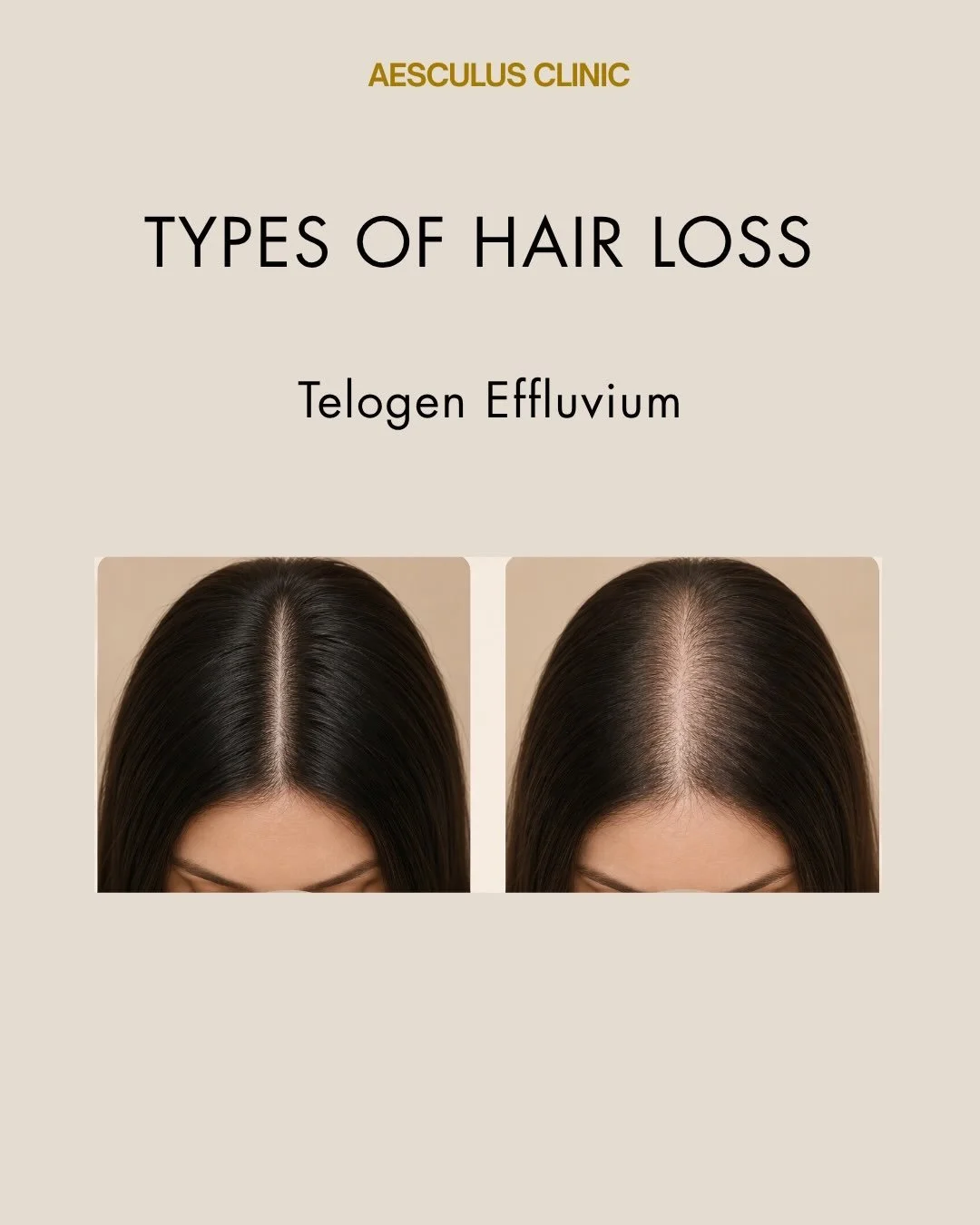 Book your appointment online.

Available at New Malden &amp; Knightsbridge 

Aesculus Clinic | Skin Clinic New Malden | Skin Clinic Knightsbridge | Anti-wrinkle treatment New Malden | Anti-wrinkle treatment Knightsbridge | Lip Filler New Malden | Lip