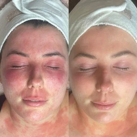 Your skin is your largest organ and it is your first line of defense! 

Book your consultation online. 

Aesculus Clinic | Medical Clinic New Malden | Dermatology New Malden | Skin Clinic New Malden
