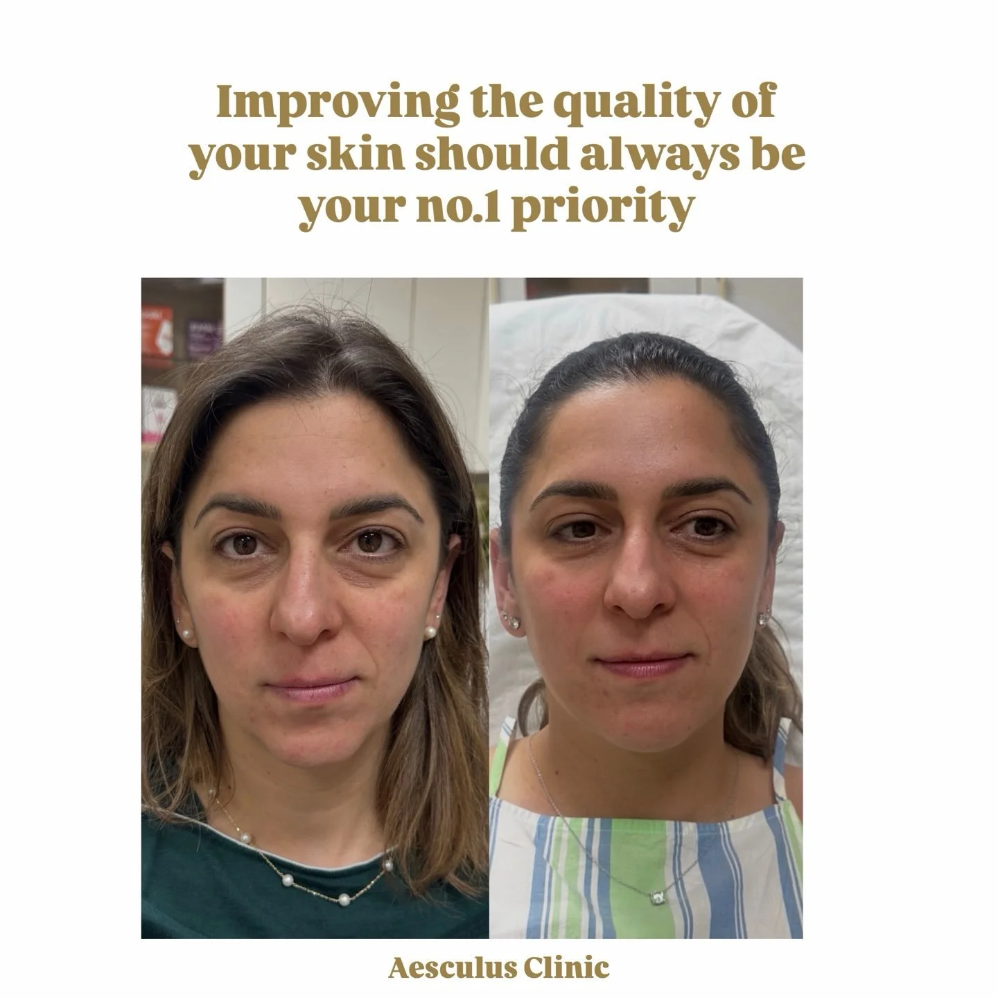 Consistency is key! Thank you for my beautiful patient for allowing me to share her journey 🤍

Book your appointment online!