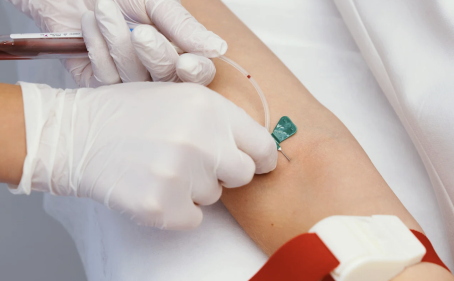 Blood tests available at Aesculus Clinic