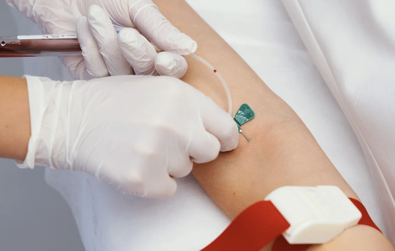 Blood tests available at Aesculus Clinic