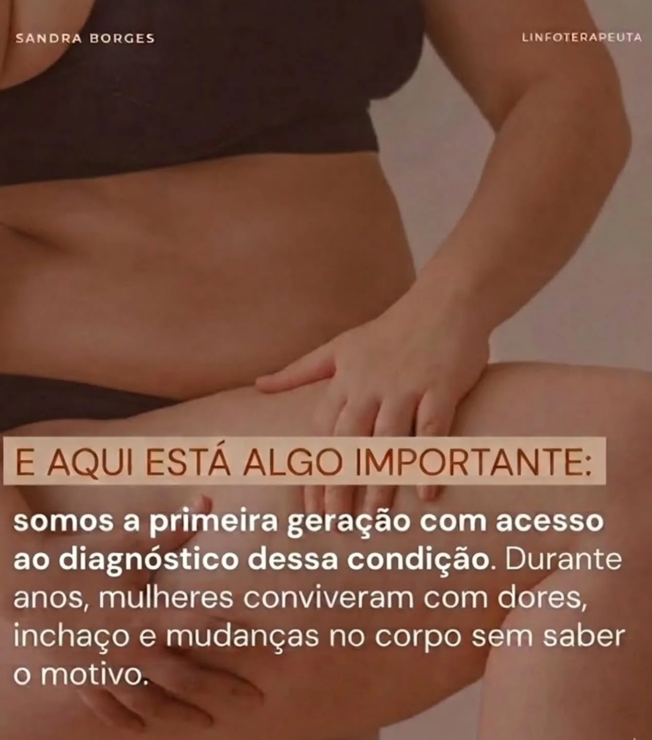 N&atilde;o &eacute; culpa tua. &Eacute; Lipedema.

O teu corpo n&atilde;o &eacute; teu inimigo. Durante anos, fomos ensinadas a culpar-nos por dores e incha&ccedil;os inexplic&aacute;veis nas pernas, ouvindo que era "apenas peso". Mas n&oac
